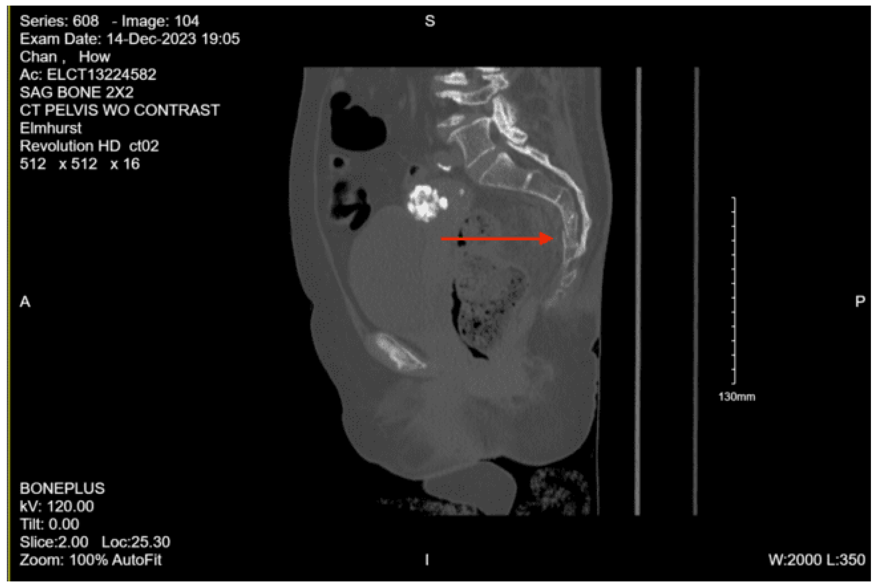 Preprints 157740 g016