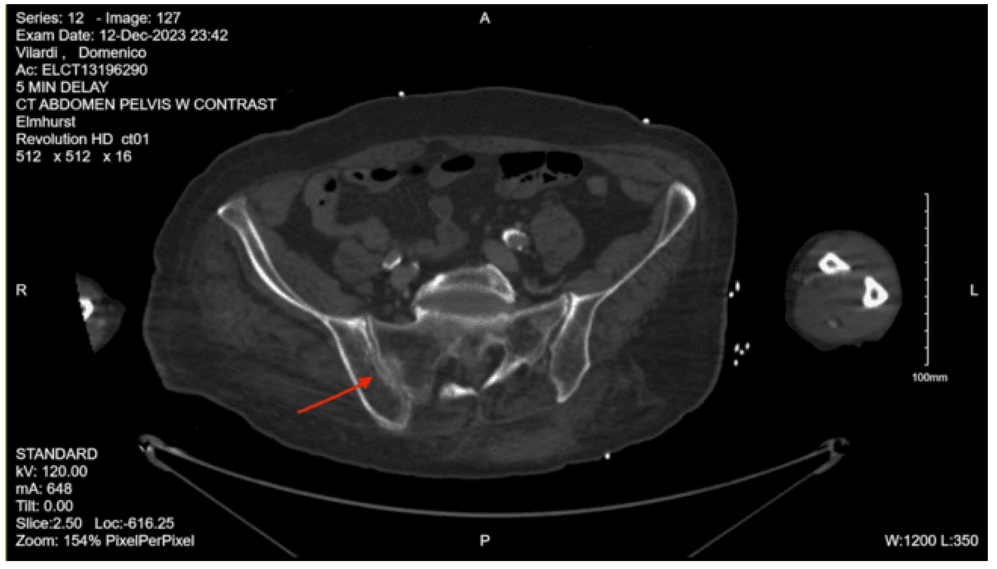 Preprints 157740 g017