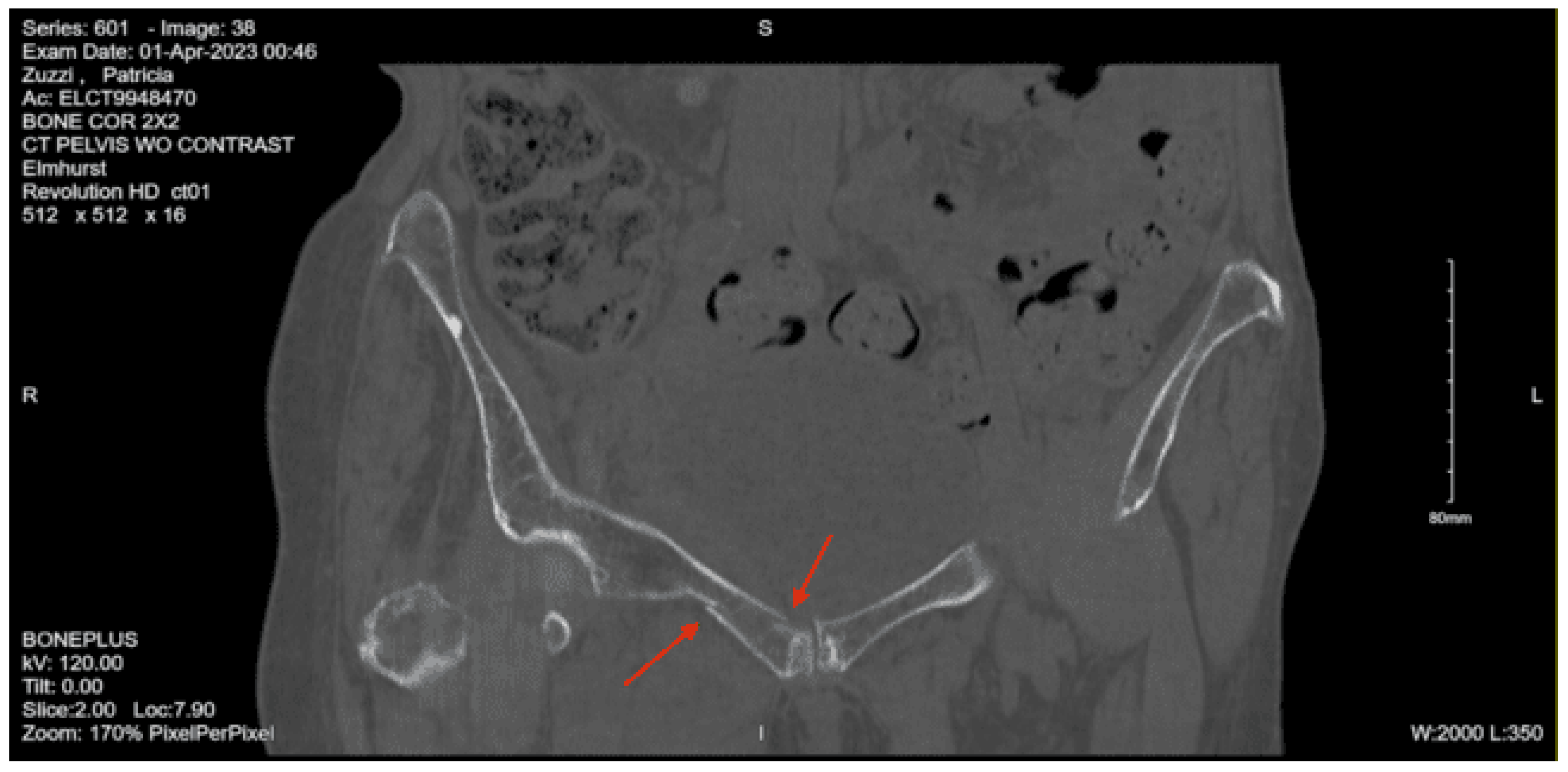 Preprints 157740 g021