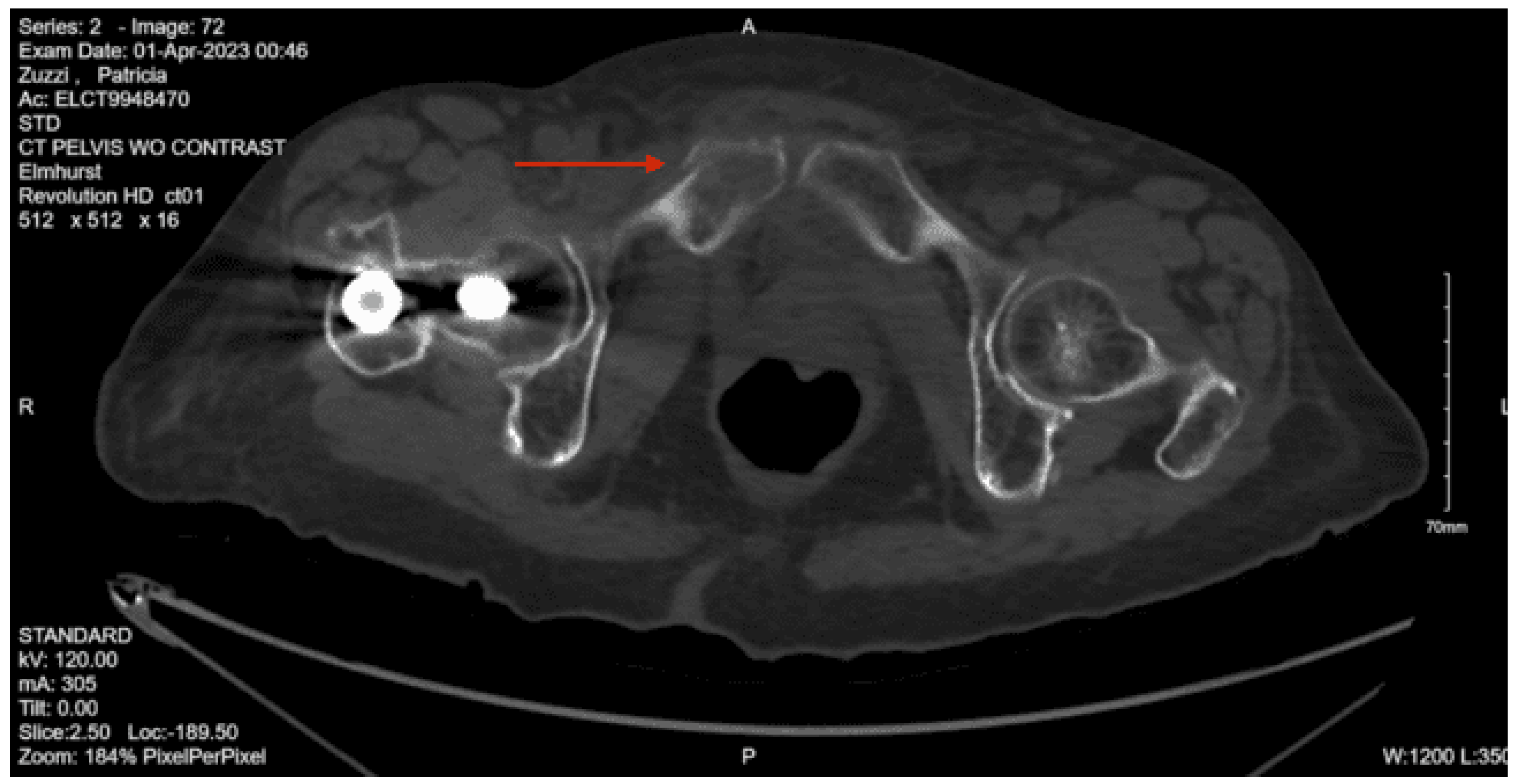 Preprints 157740 g022