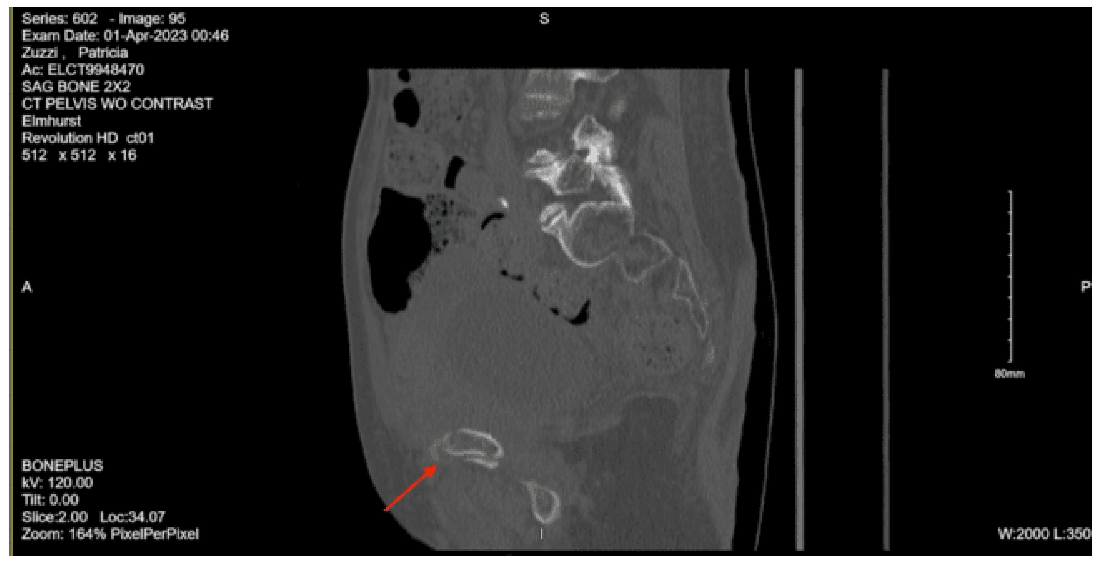 Preprints 157740 g023