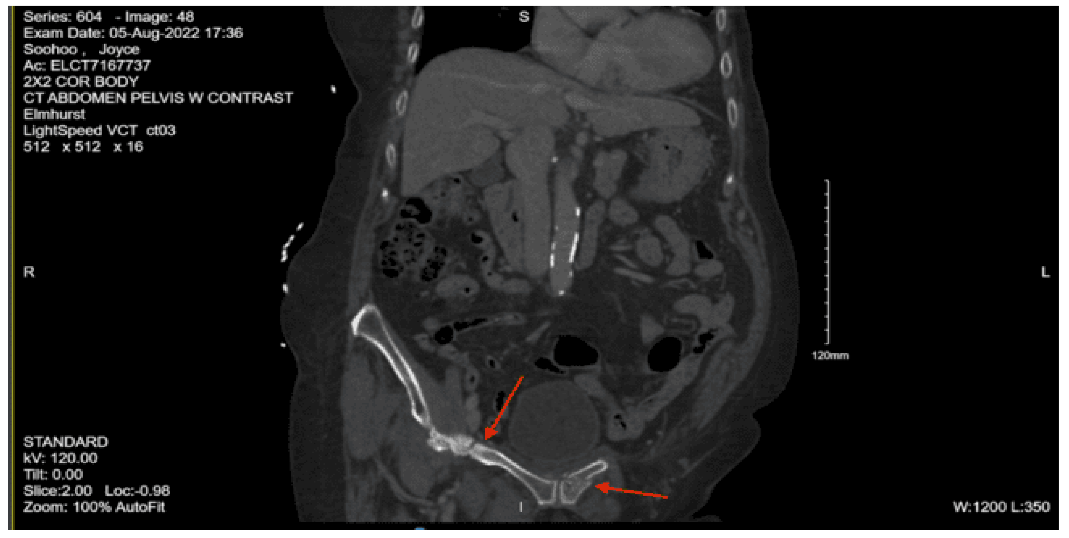 Preprints 157740 g025