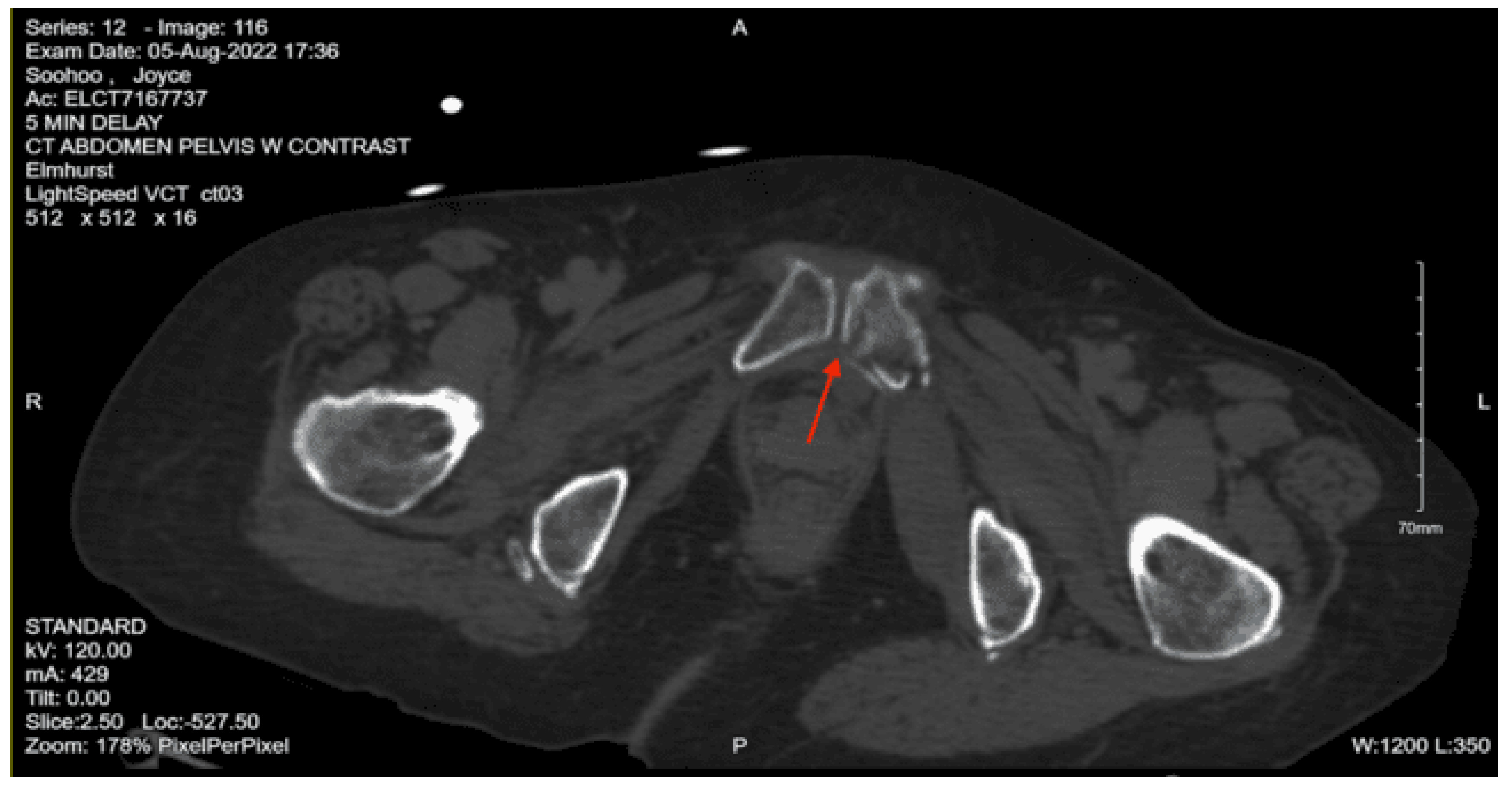 Preprints 157740 g026