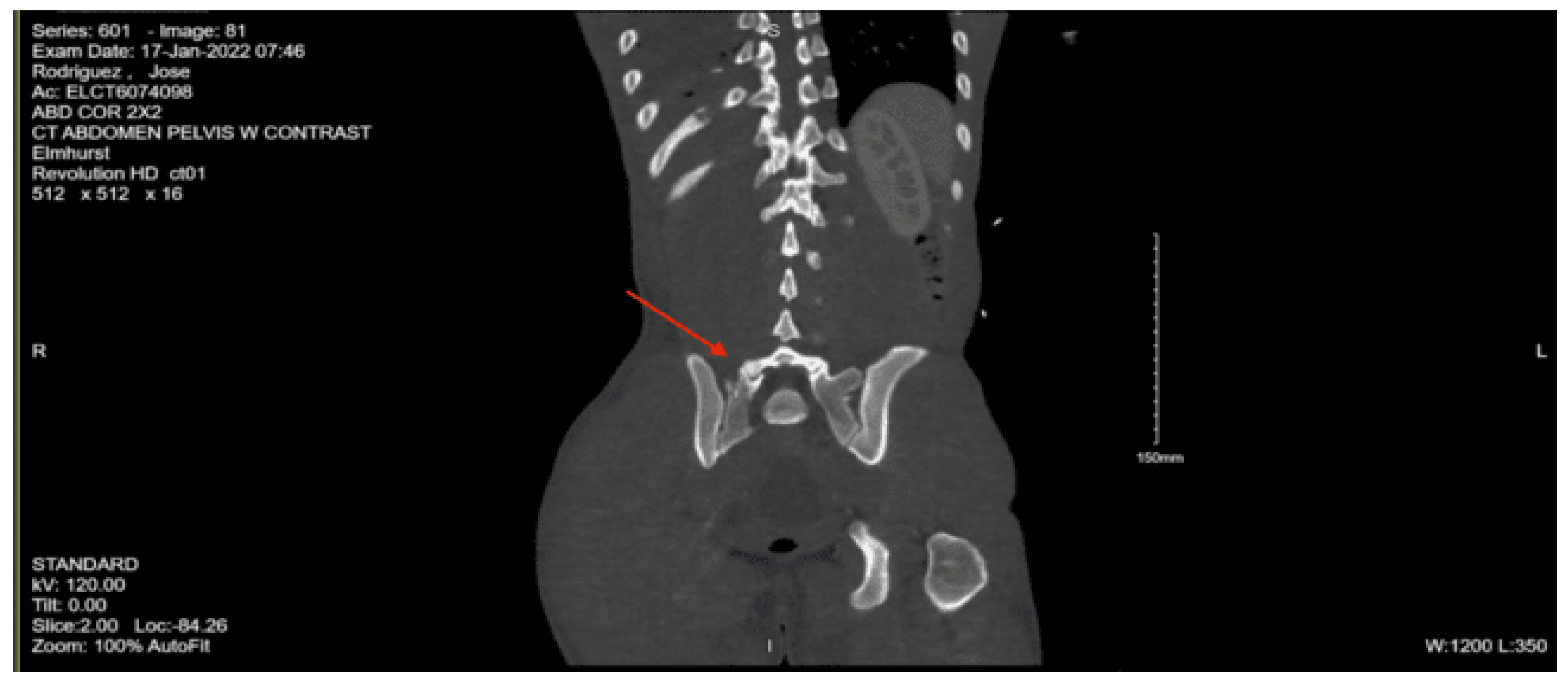 Preprints 157740 g027