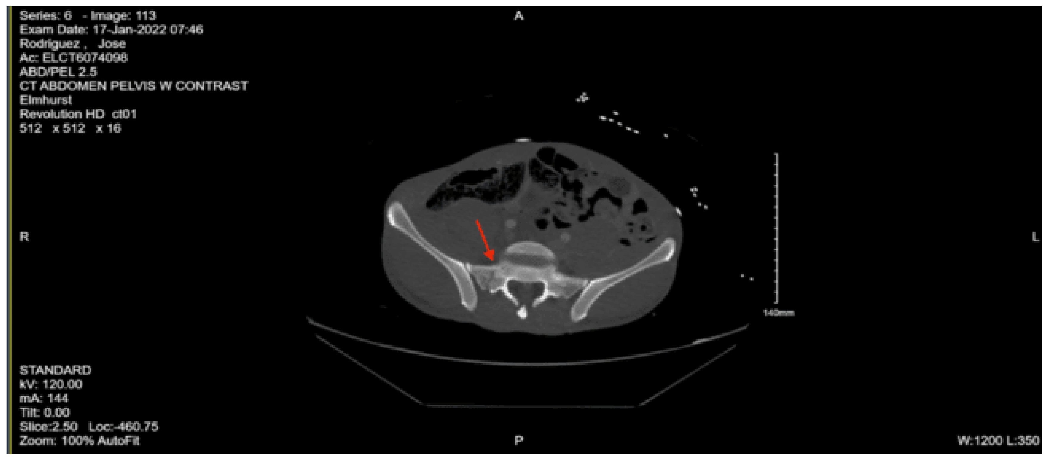 Preprints 157740 g029