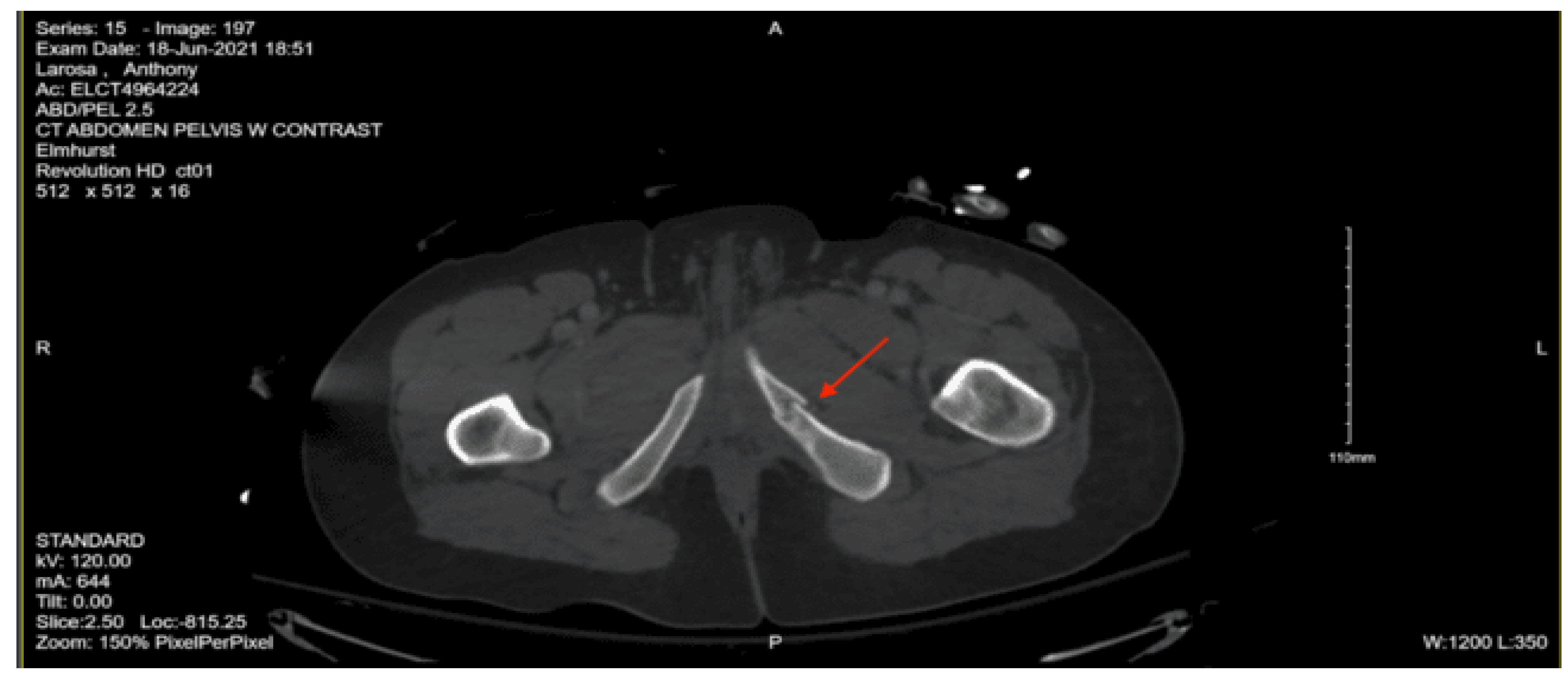 Preprints 157740 g031