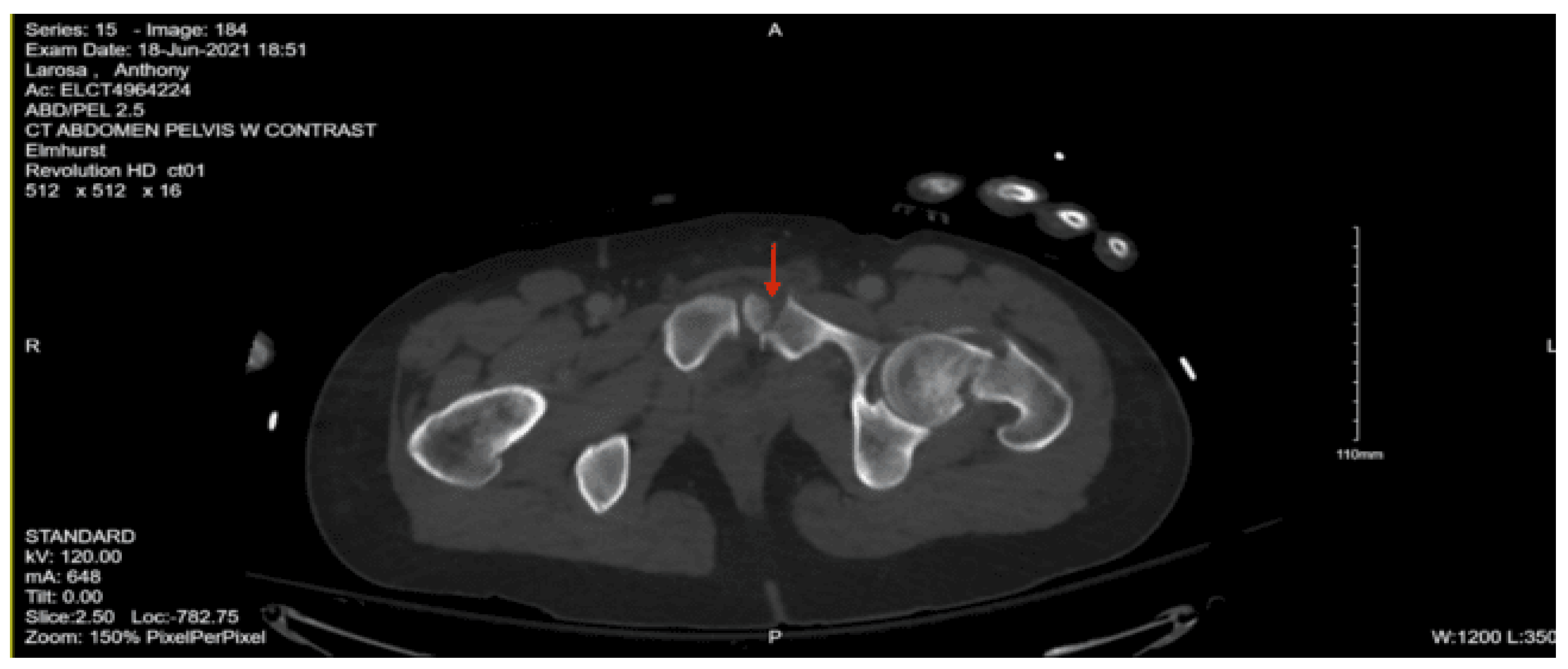 Preprints 157740 g033