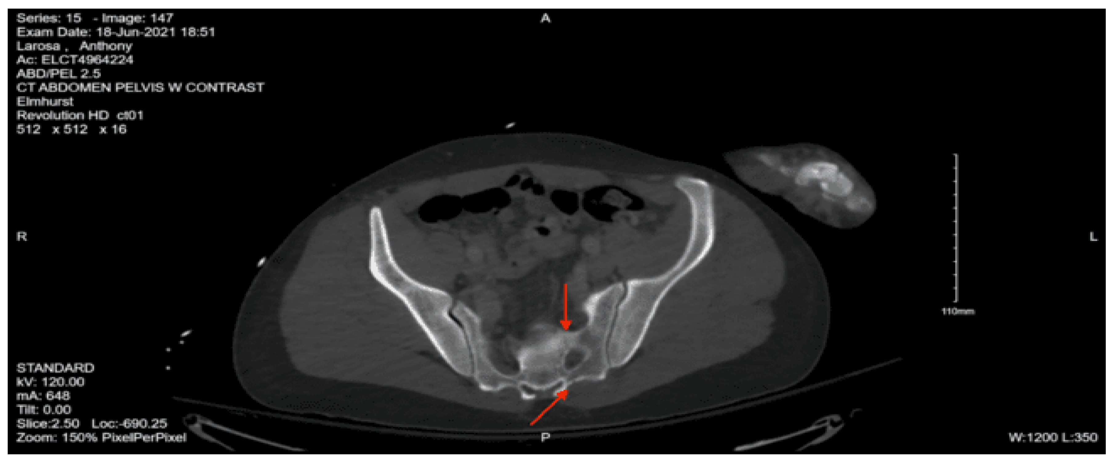 Preprints 157740 g034