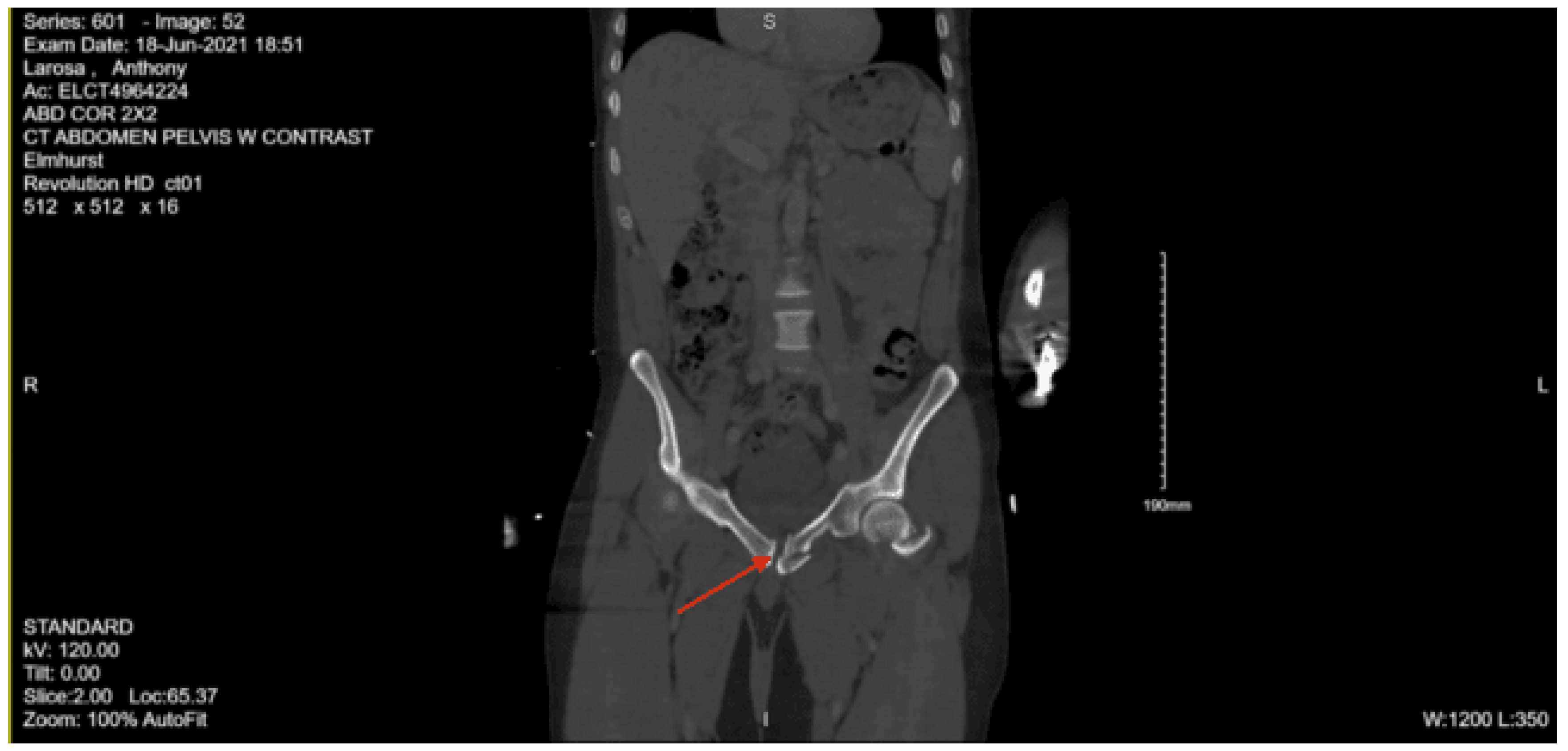 Preprints 157740 g036