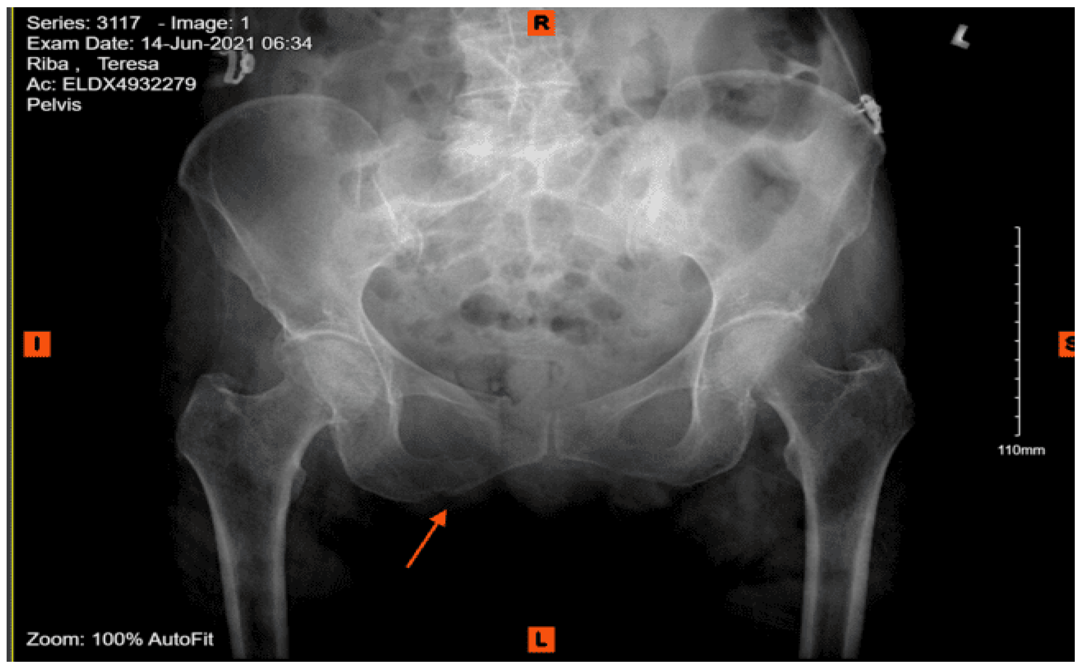 Preprints 157740 g037
