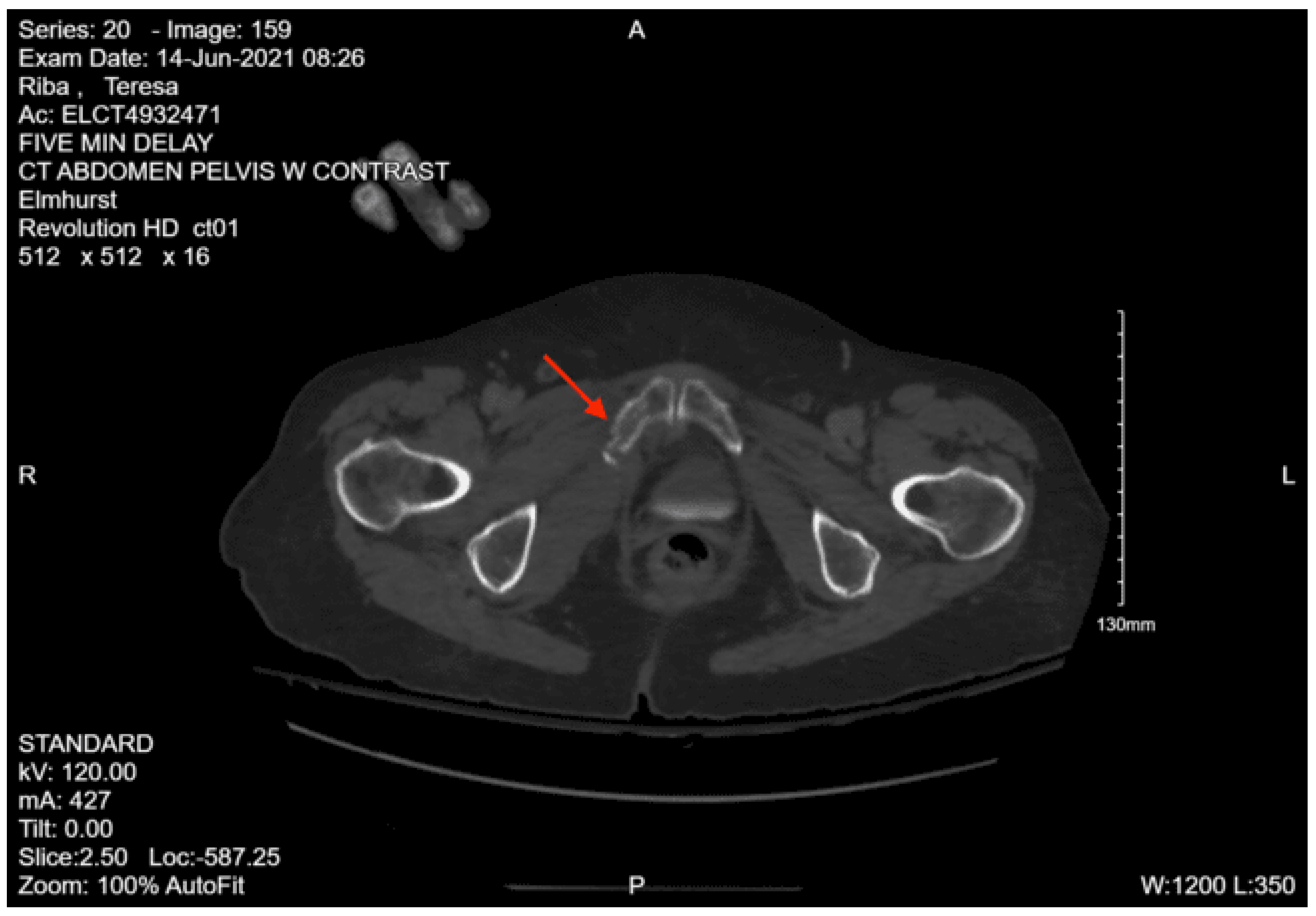 Preprints 157740 g039