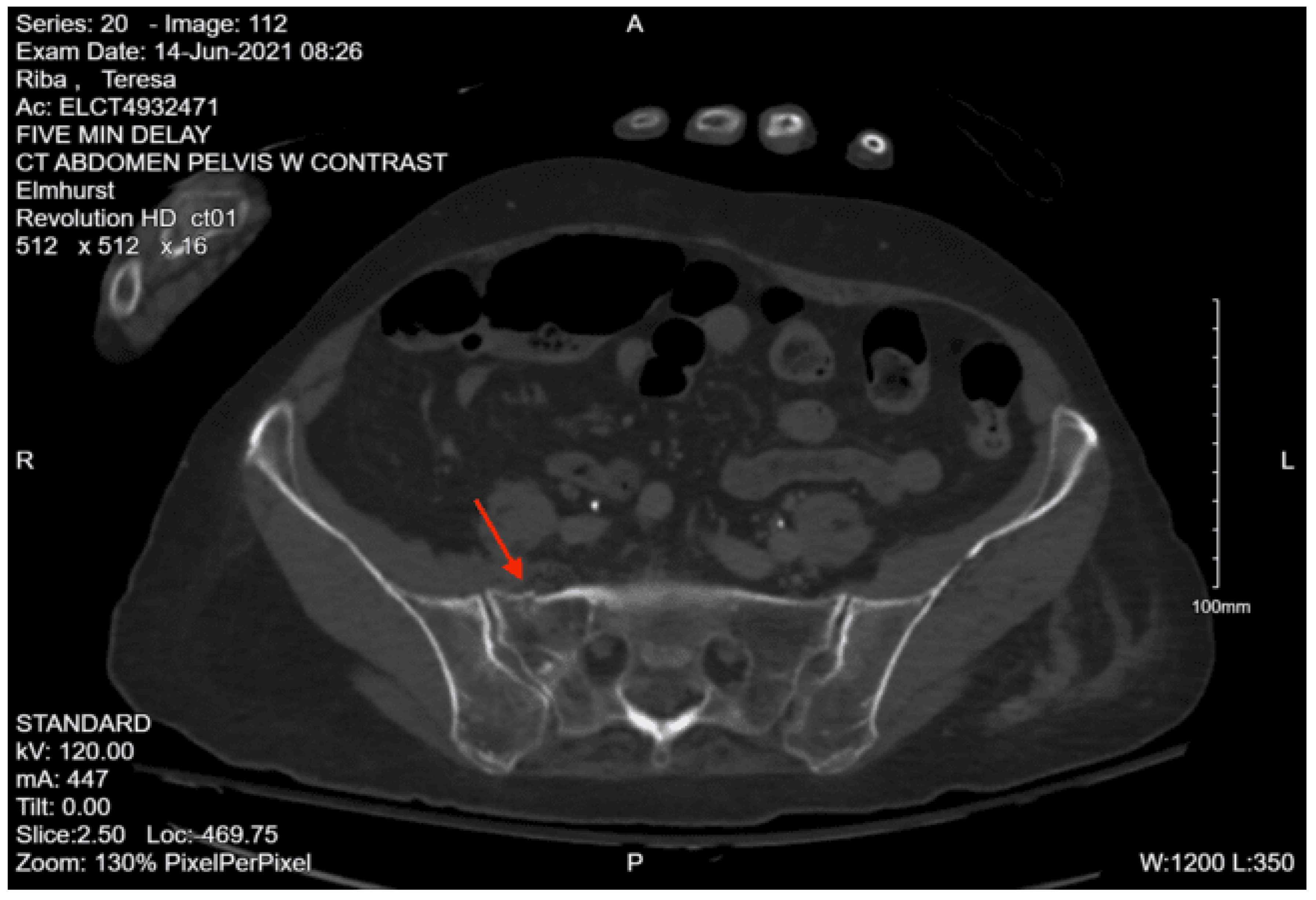 Preprints 157740 g040