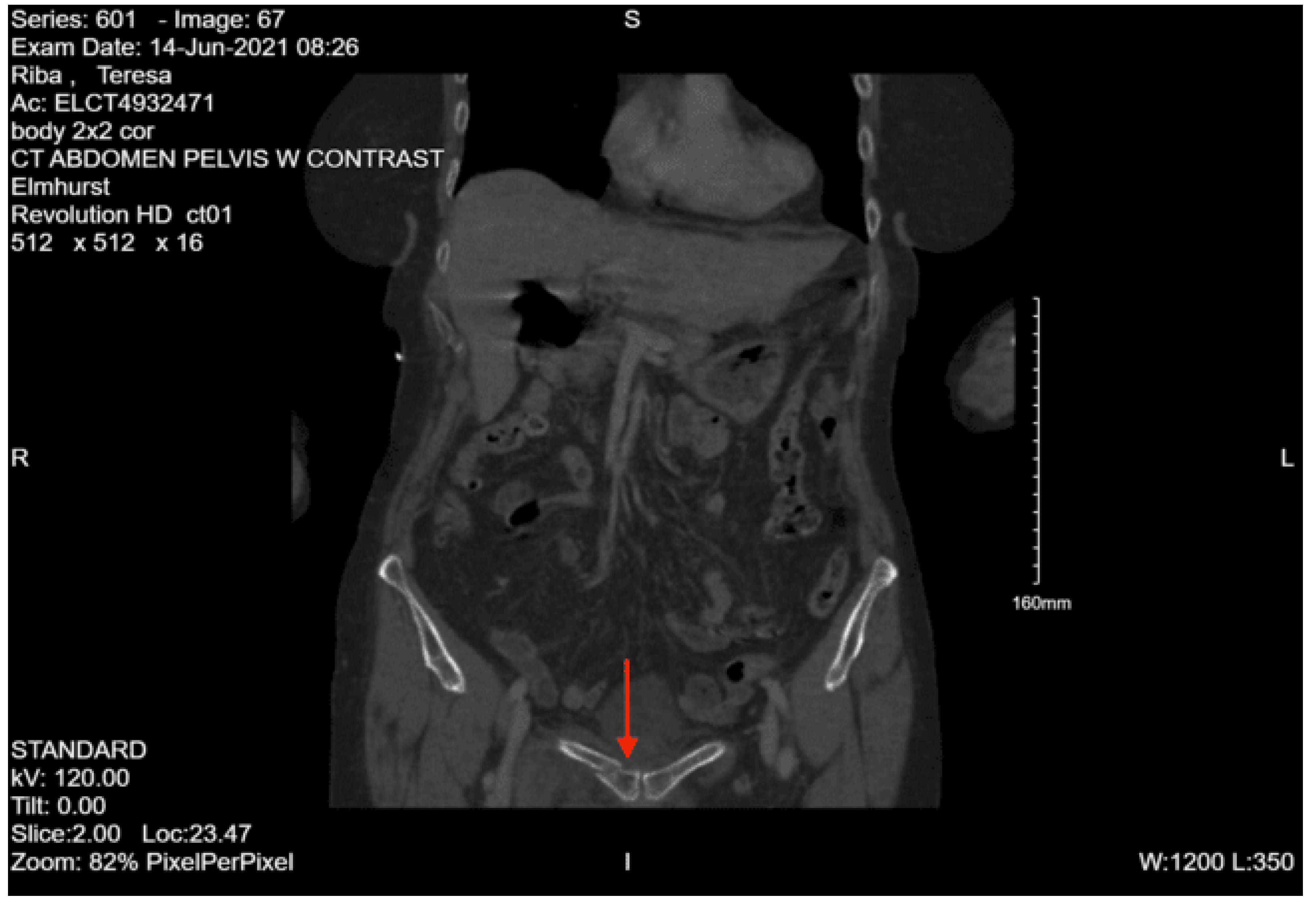 Preprints 157740 g041