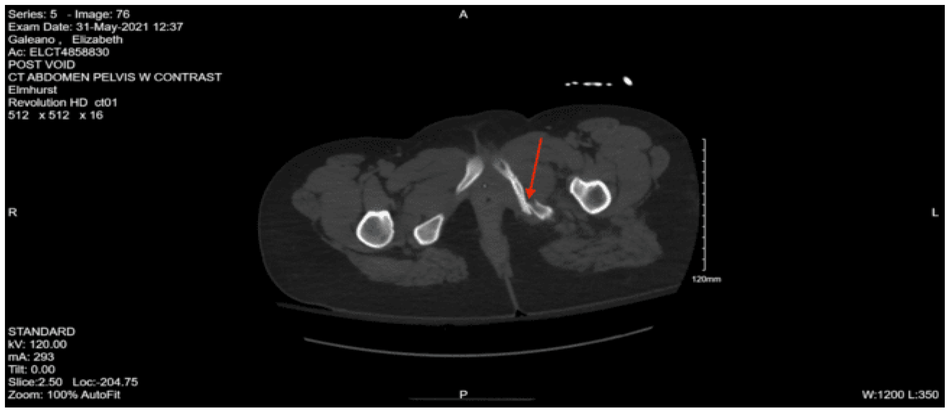 Preprints 157740 g043