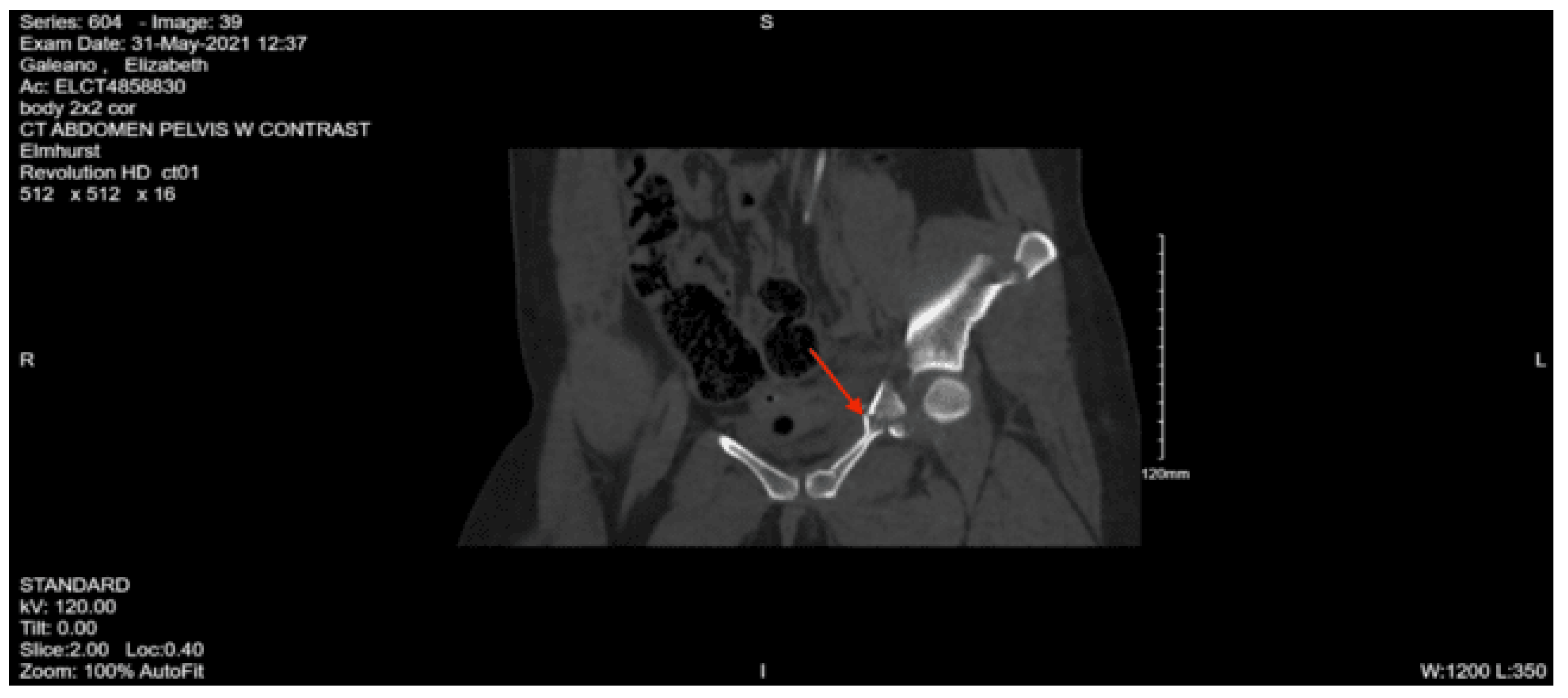 Preprints 157740 g044