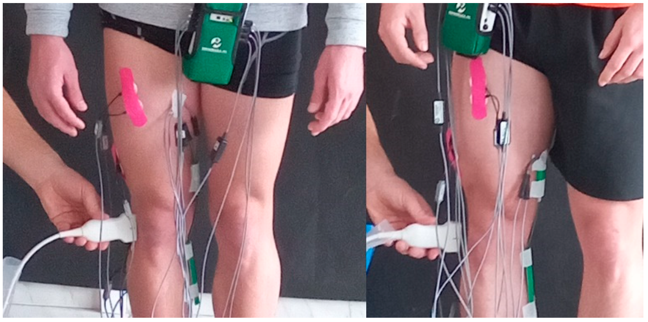 Preprints 90174 g003