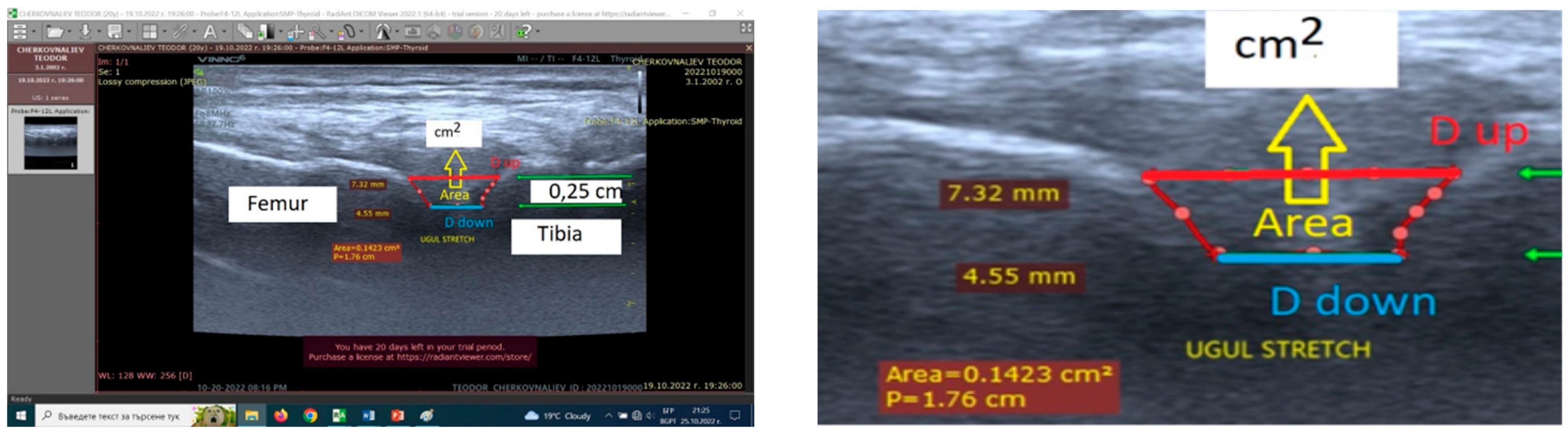 Preprints 90174 g005
