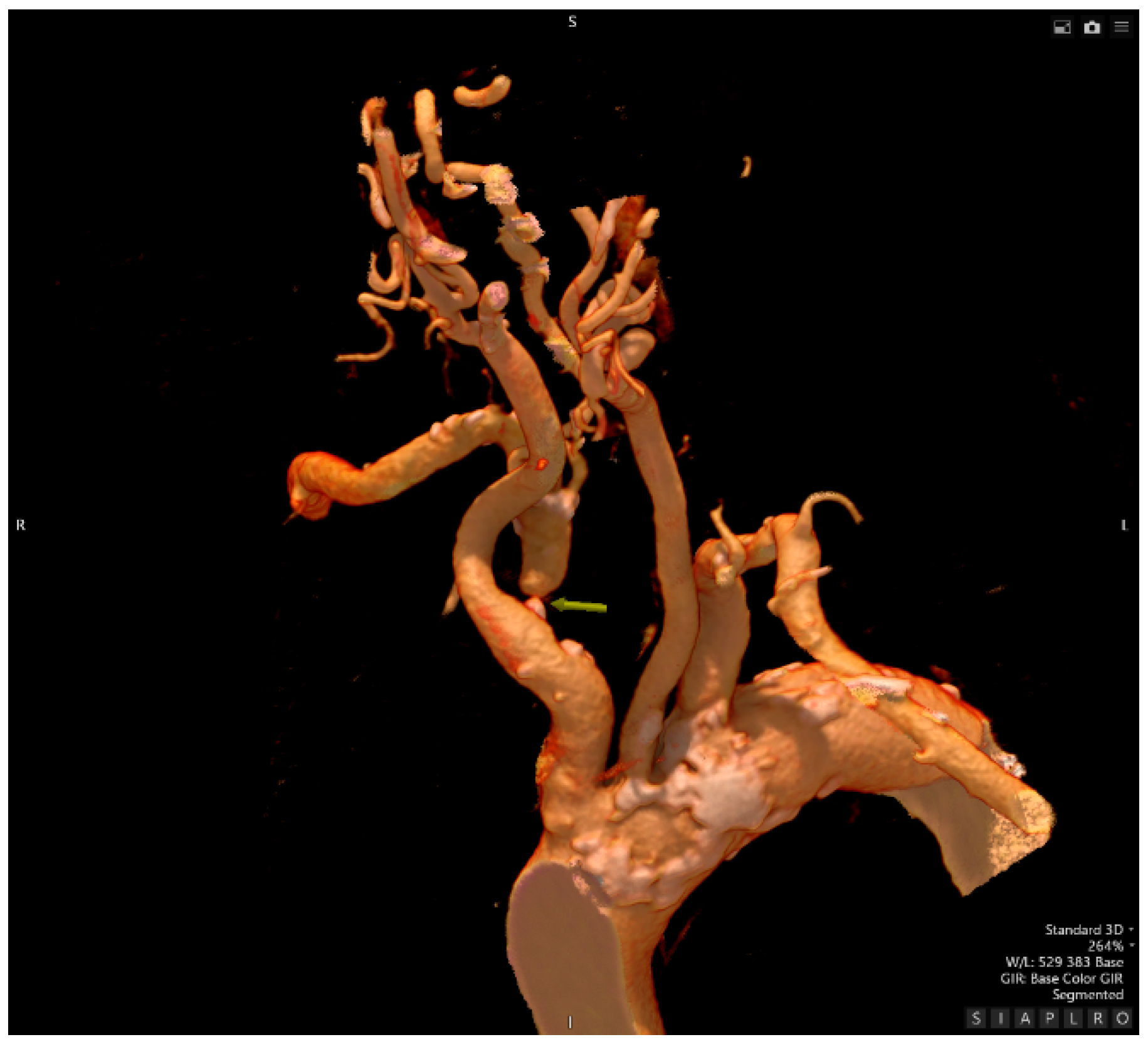 Preprints 176147 g002