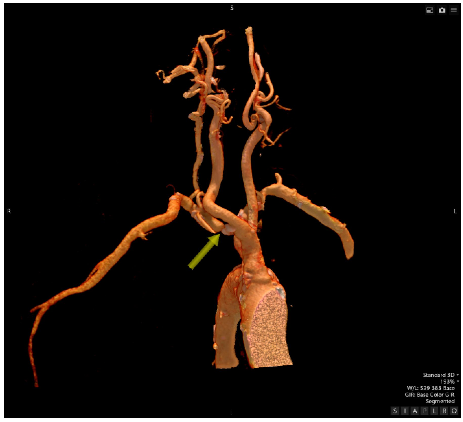 Preprints 176147 g003