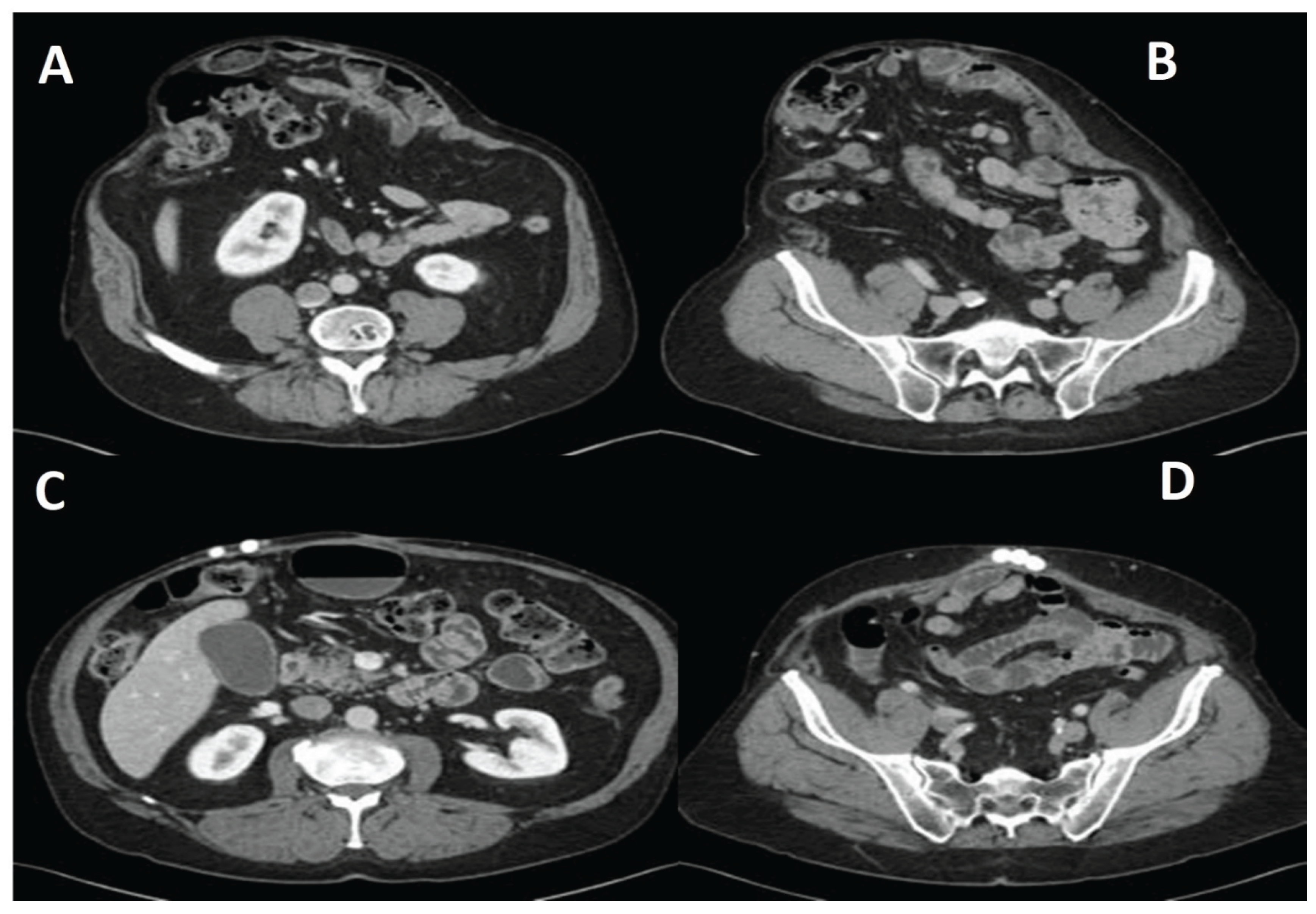 Preprints 181368 g001