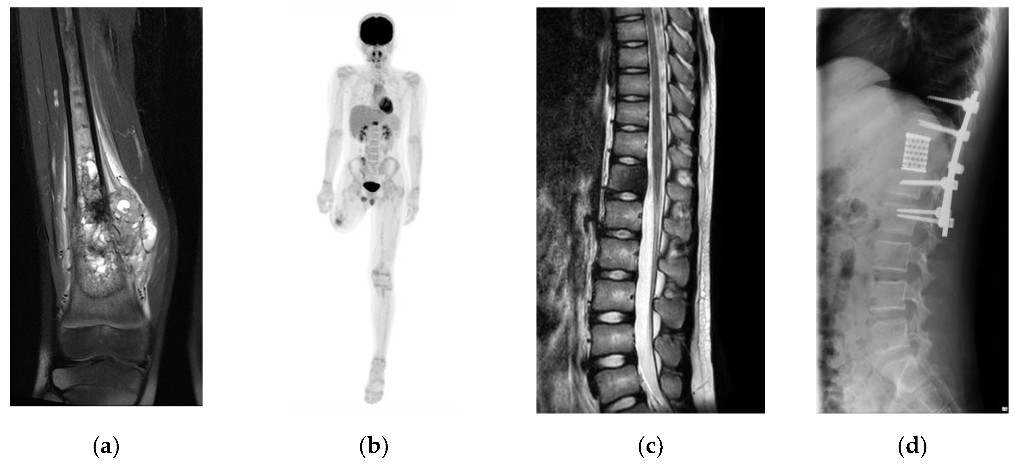 Preprints 163901 g002