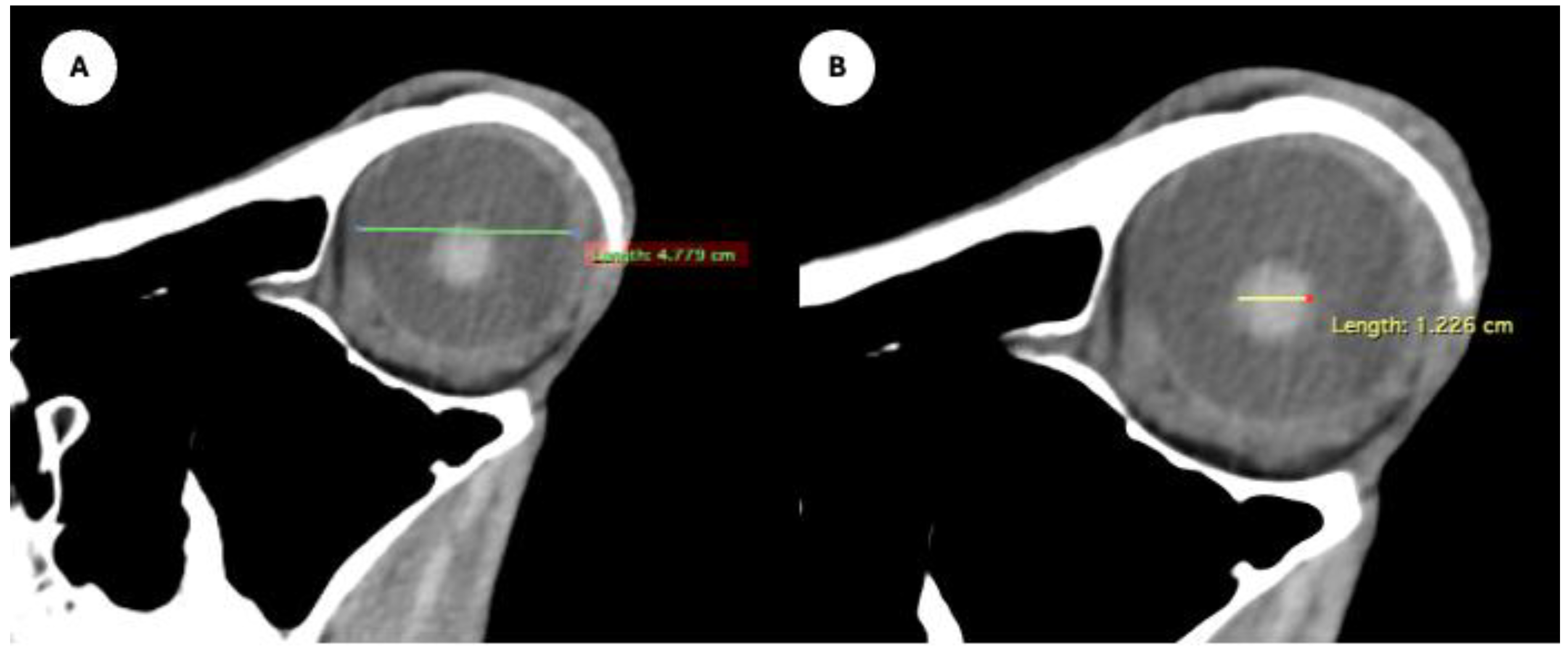 Preprints 170933 g004