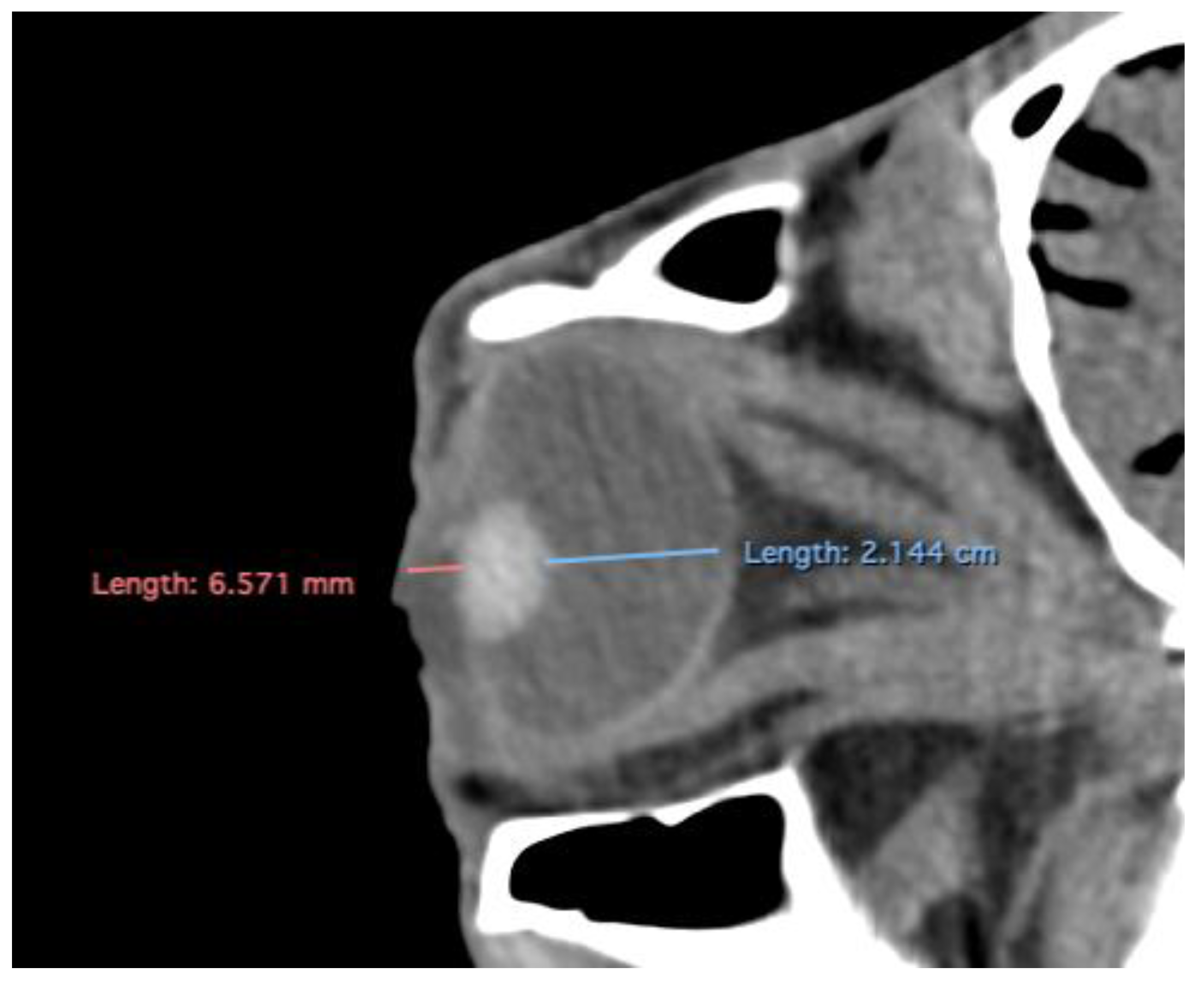 Preprints 170933 g005