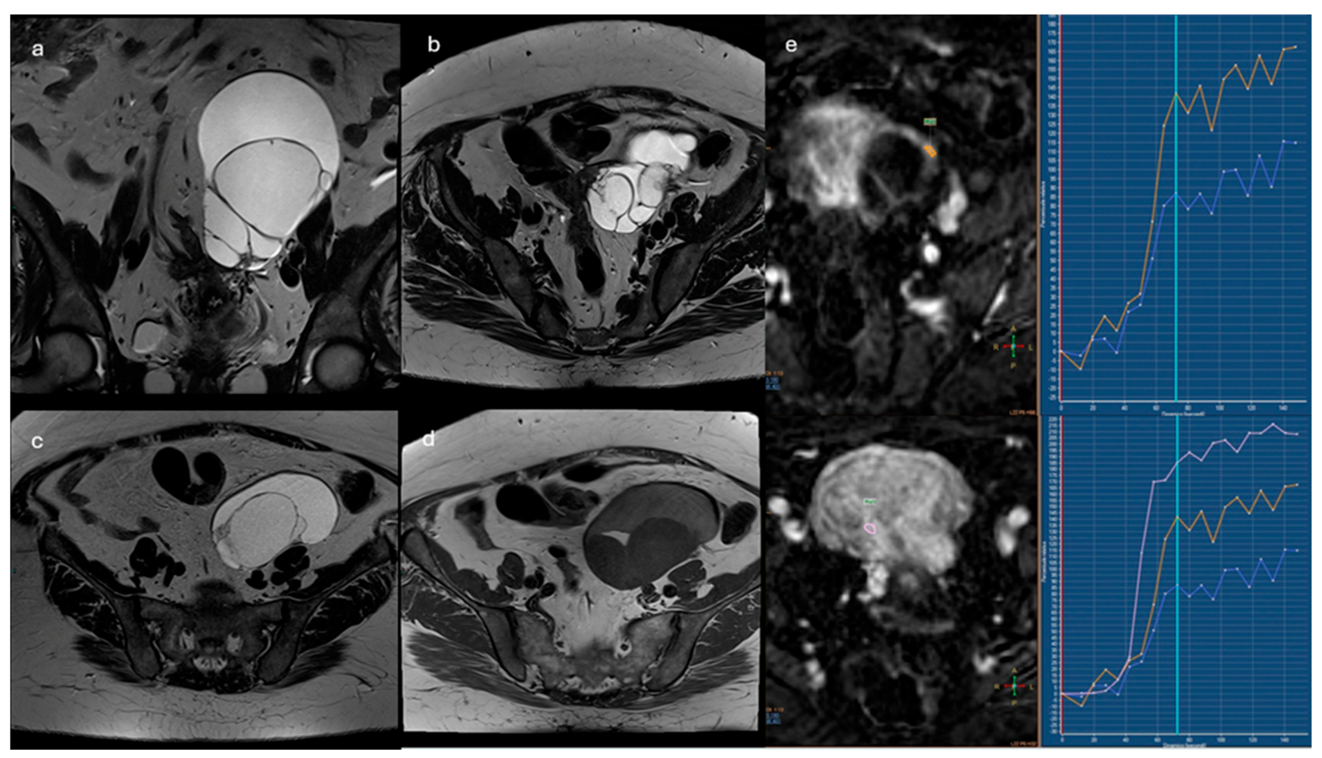 Preprints 175860 g004