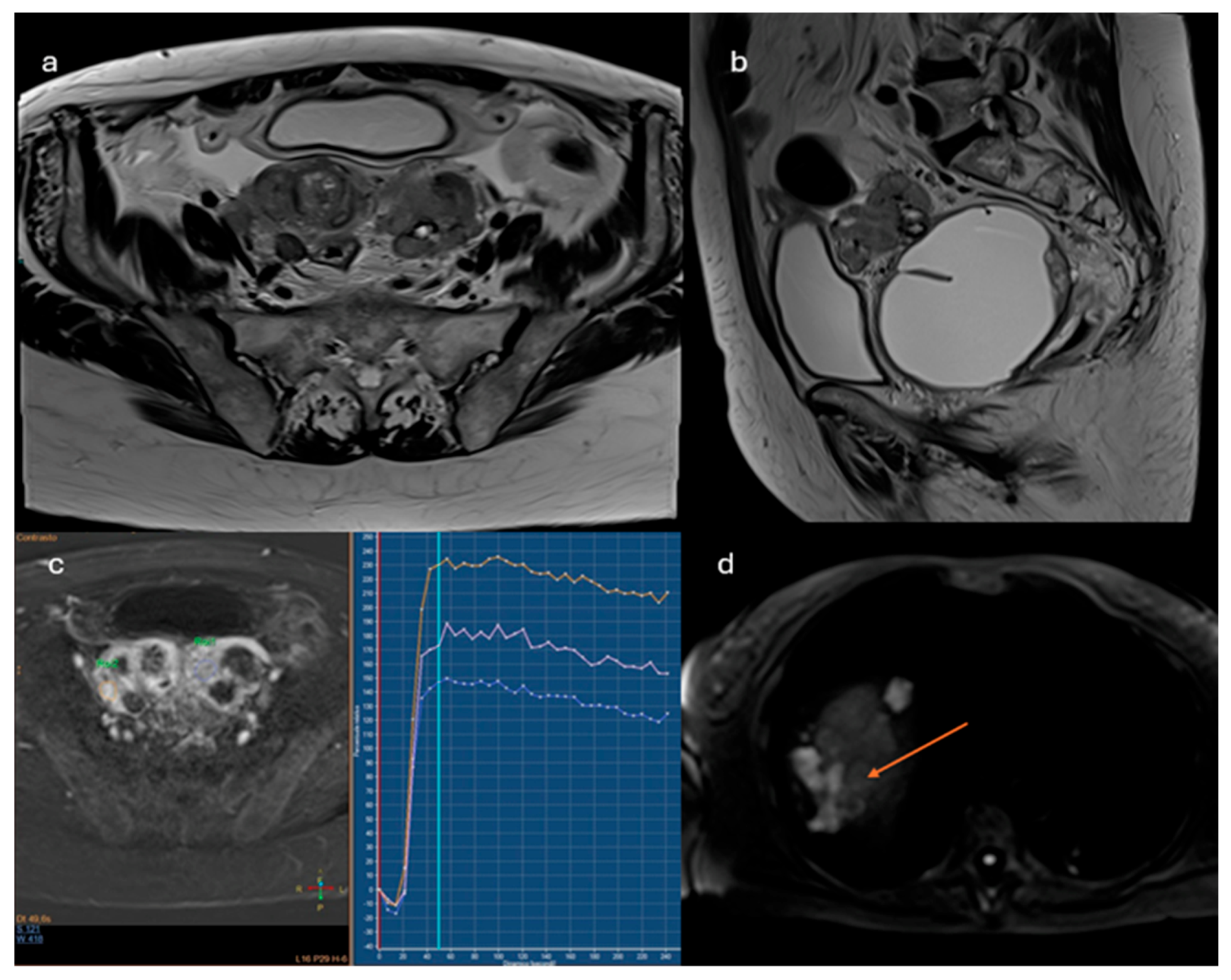 Preprints 175860 g005