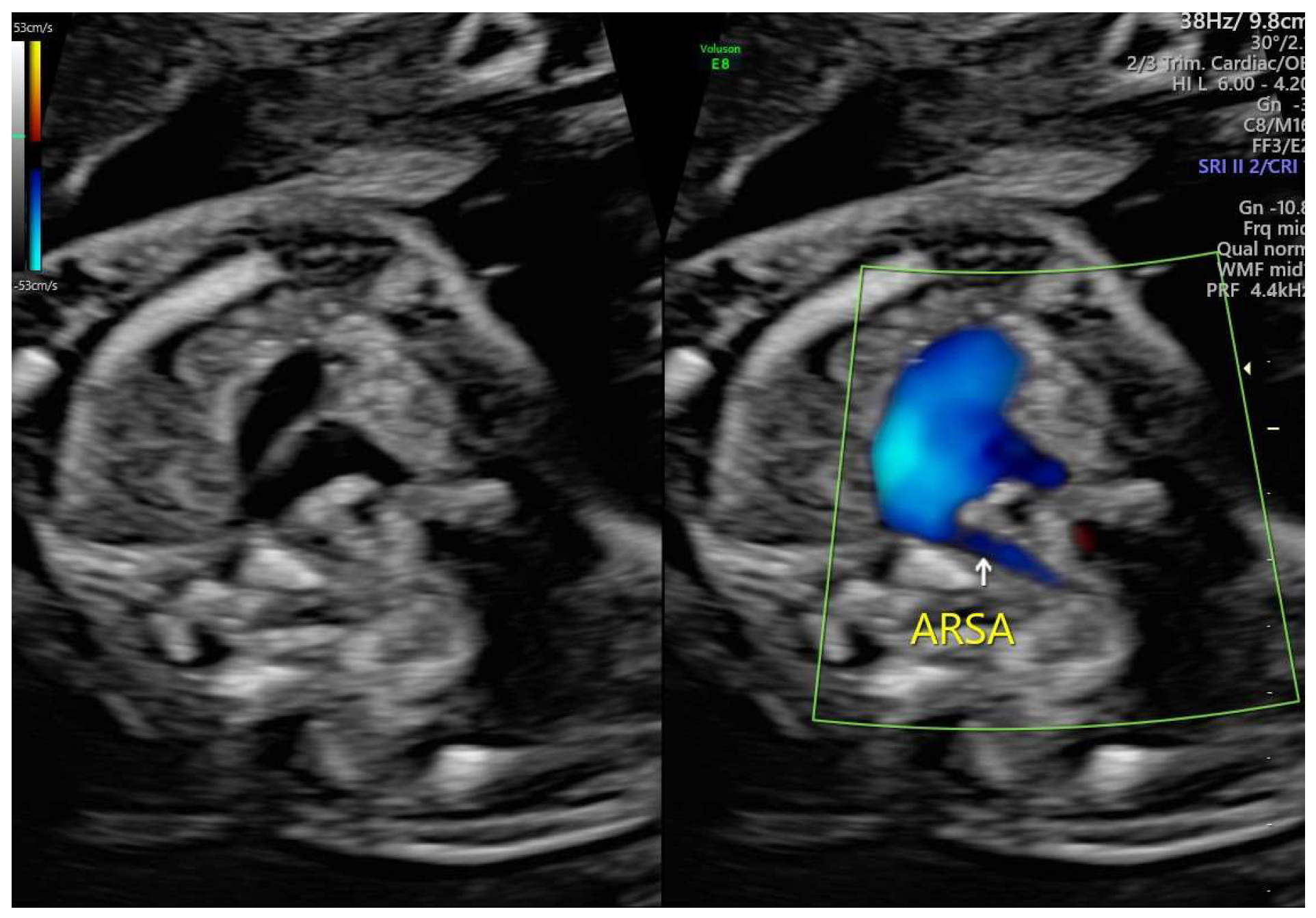 Preprints 150833 g001