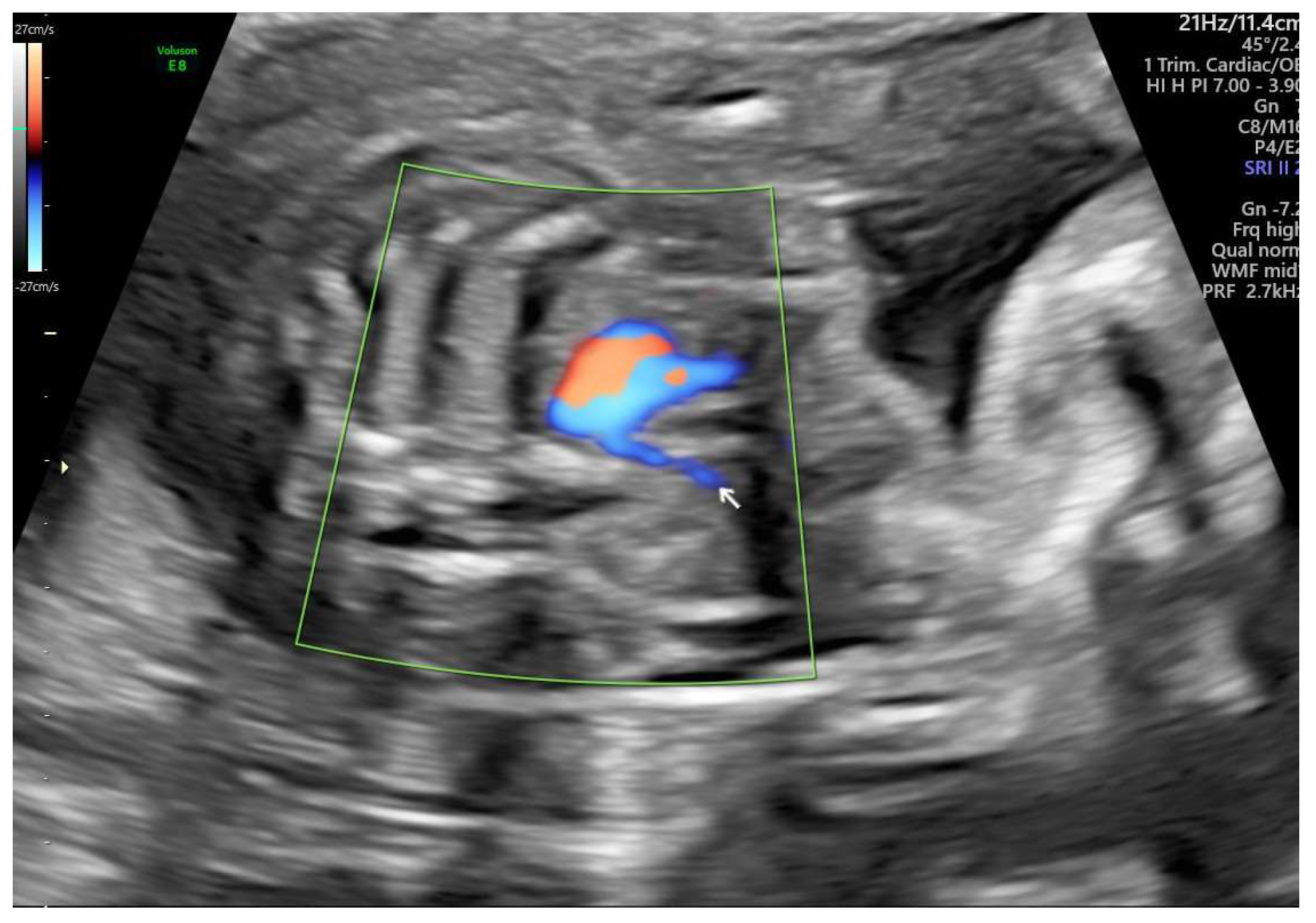 Preprints 150833 g002