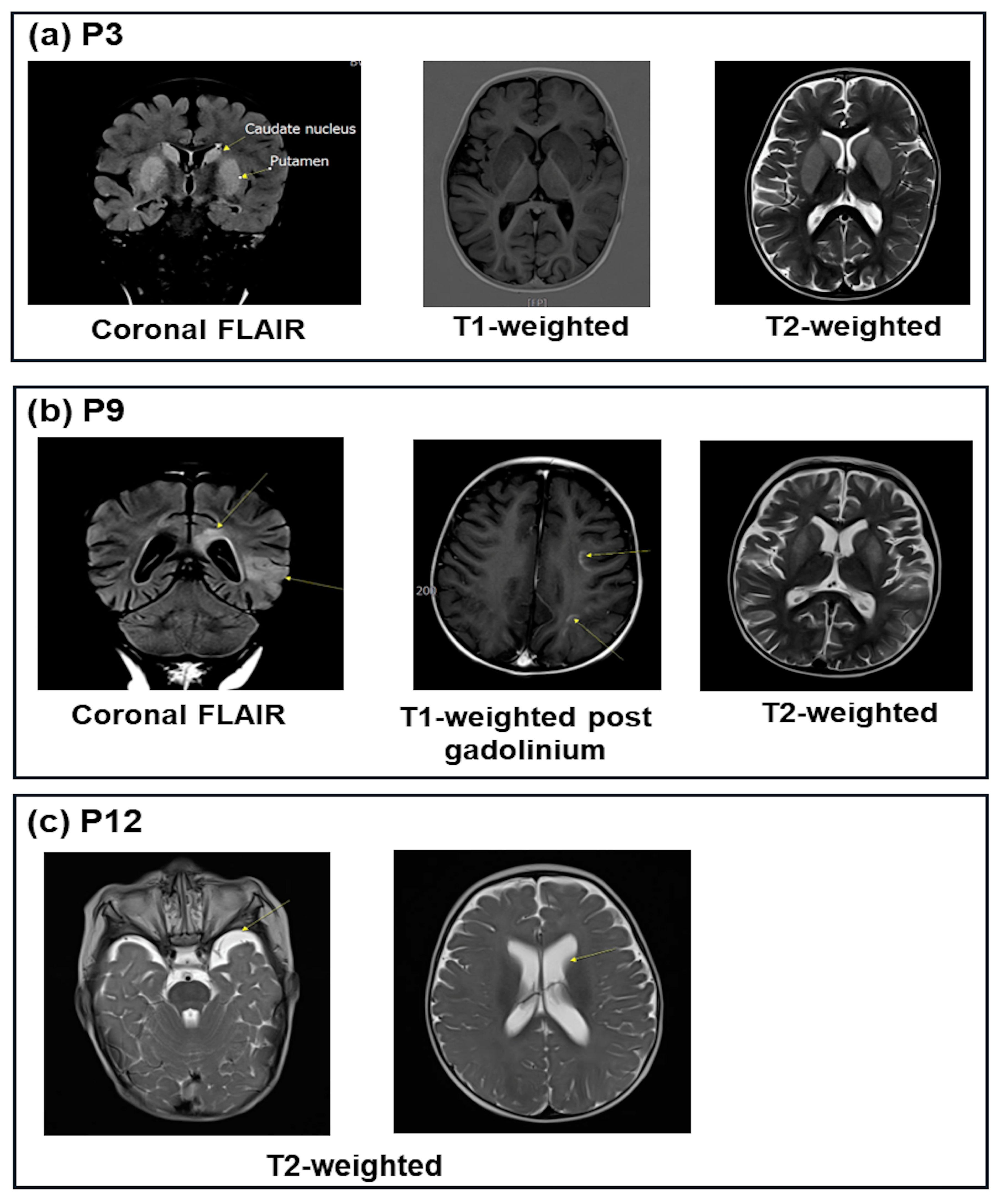 Preprints 146642 g001
