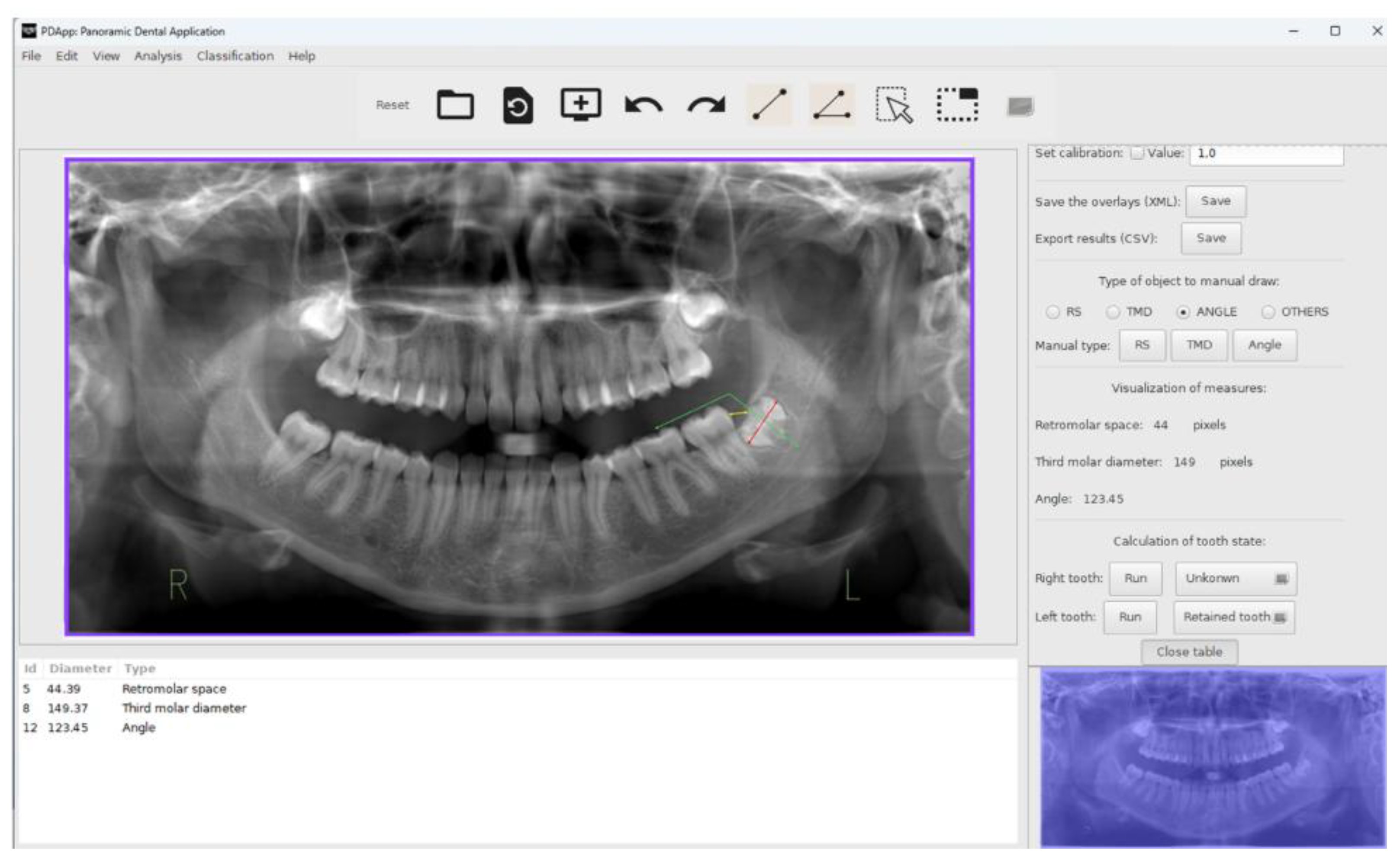 Preprints 188102 g001