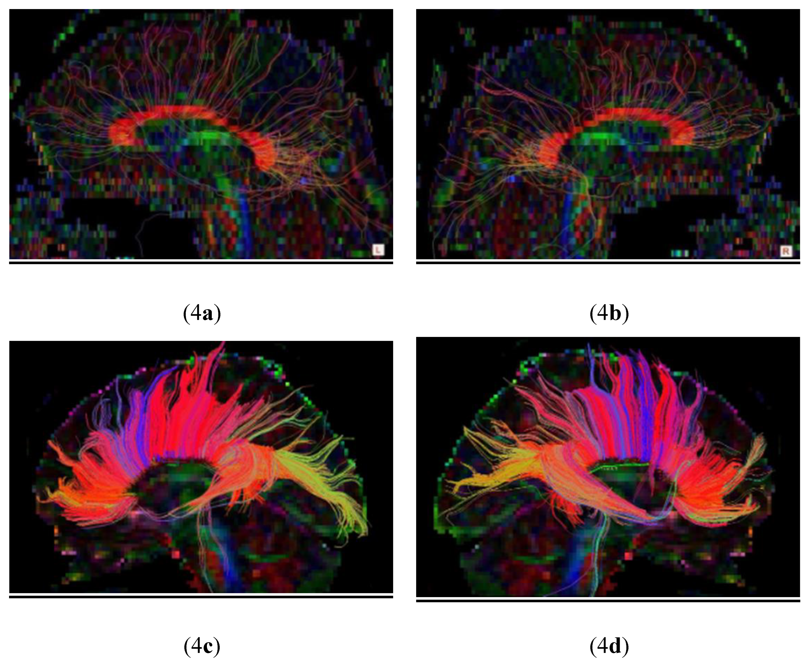 Preprints 226519 g004 Preprints 226519 g004