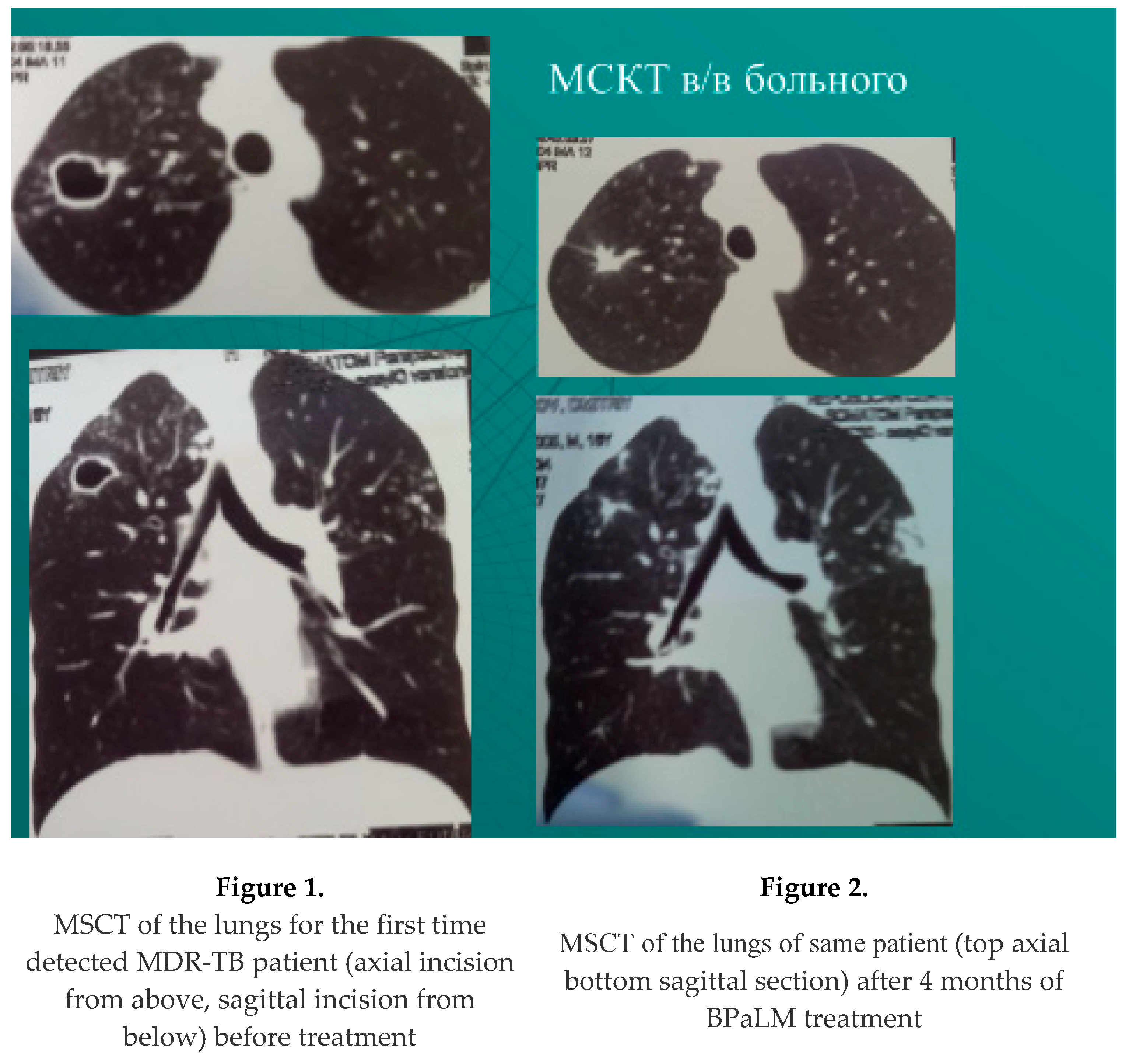 Preprints 178033 i001