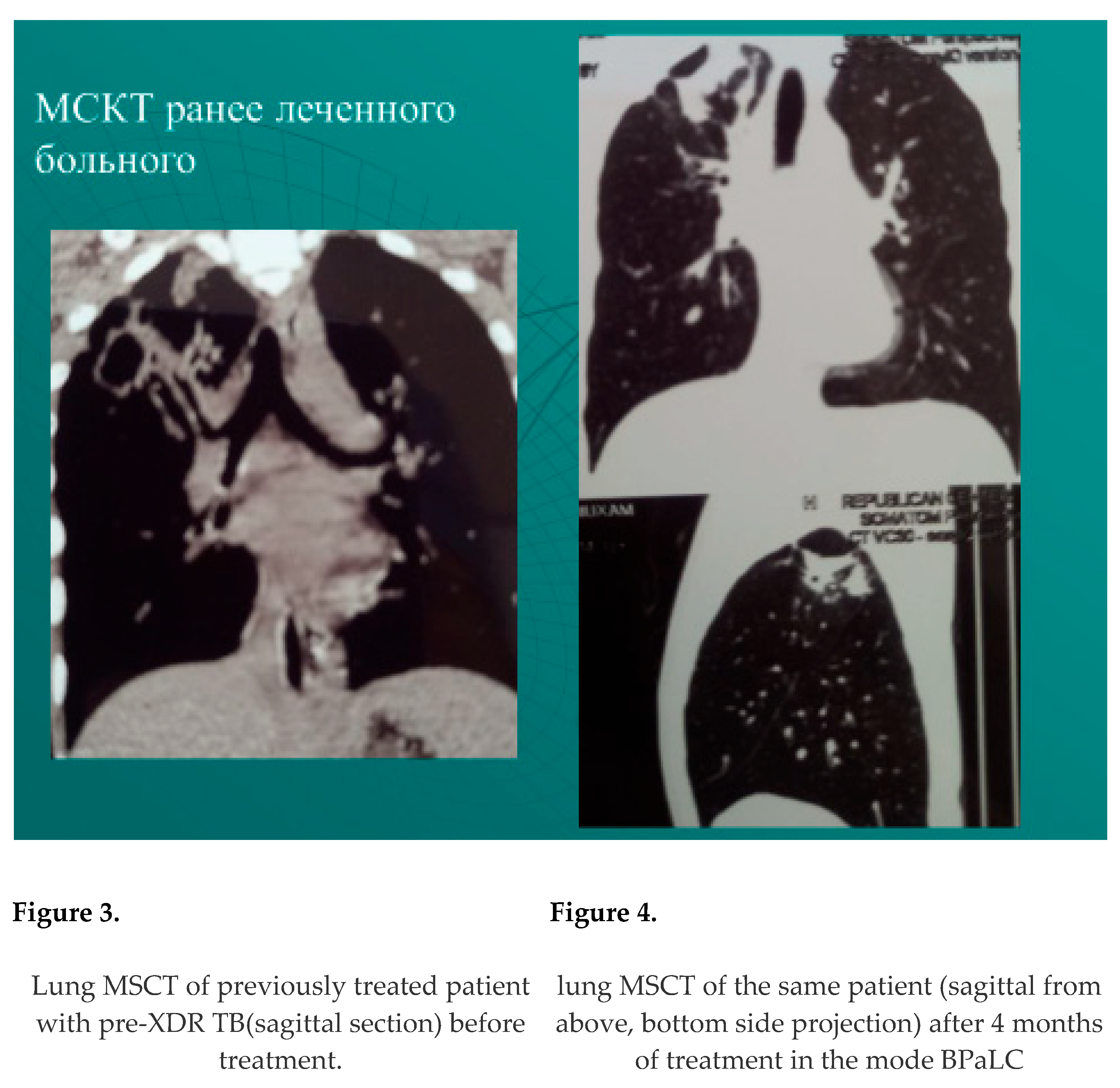 Preprints 178033 i002