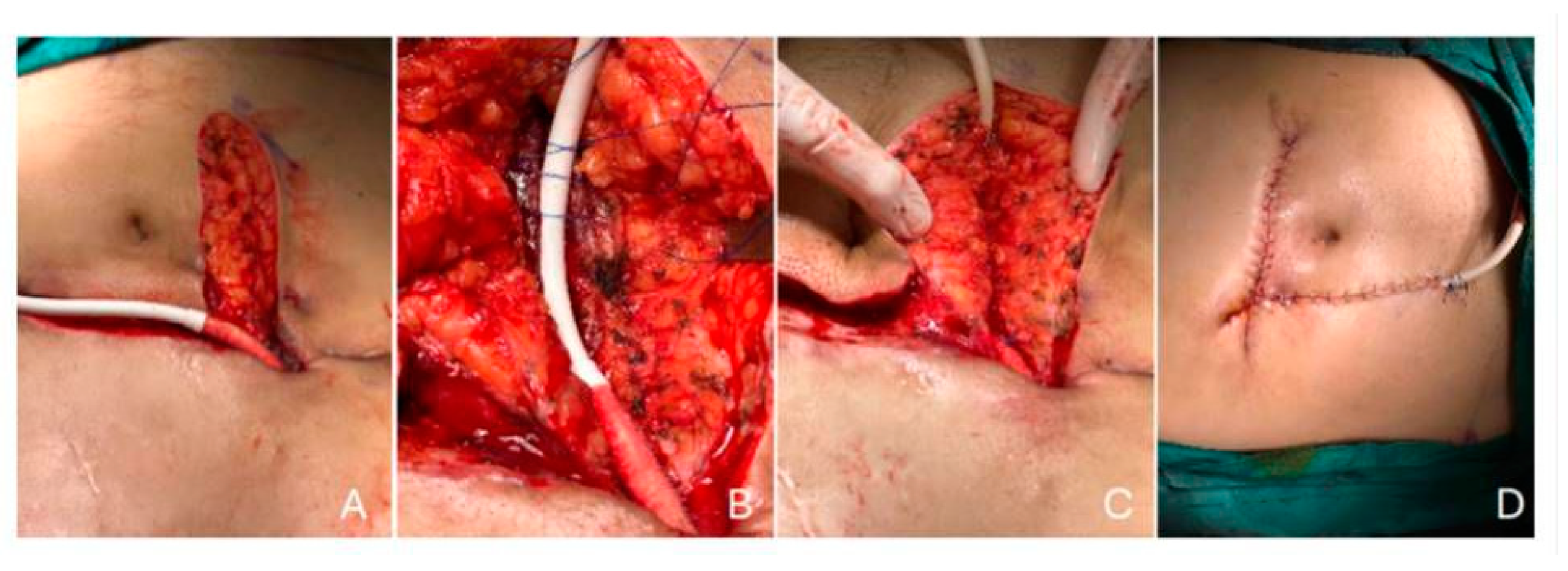 Preprints 155257 g005