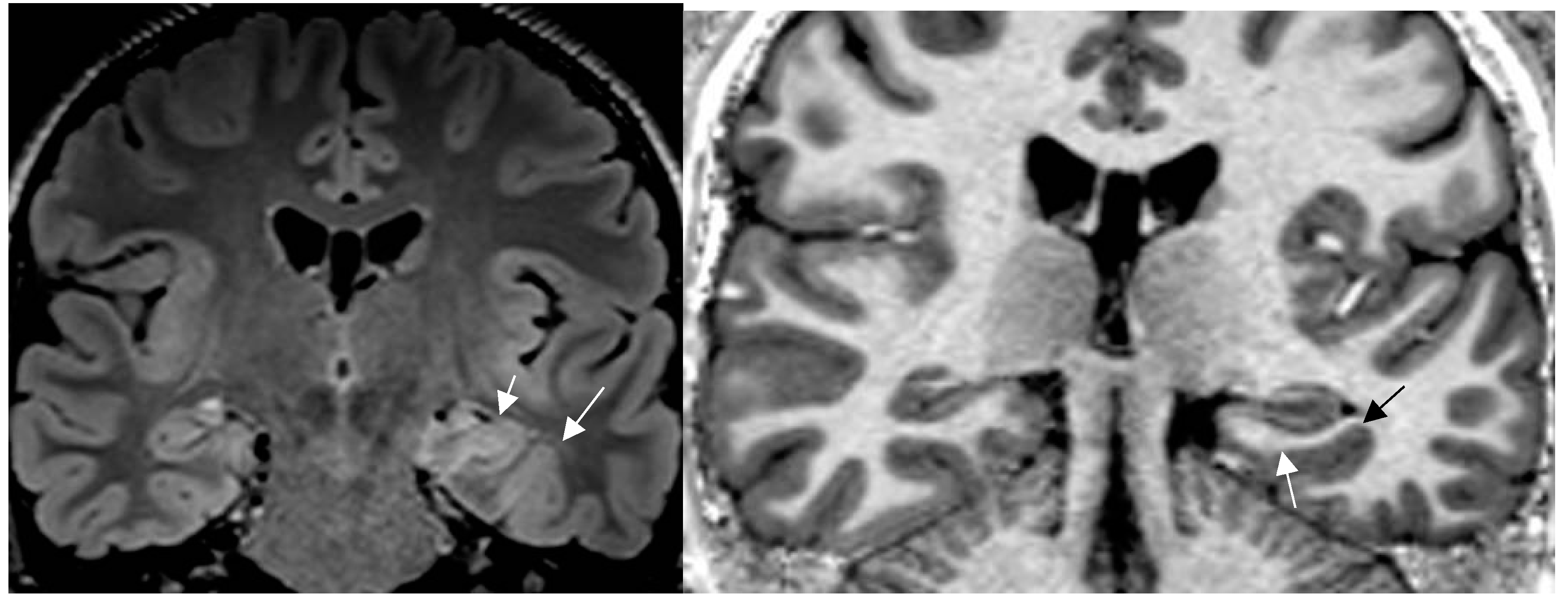 Preprints 151405 g001