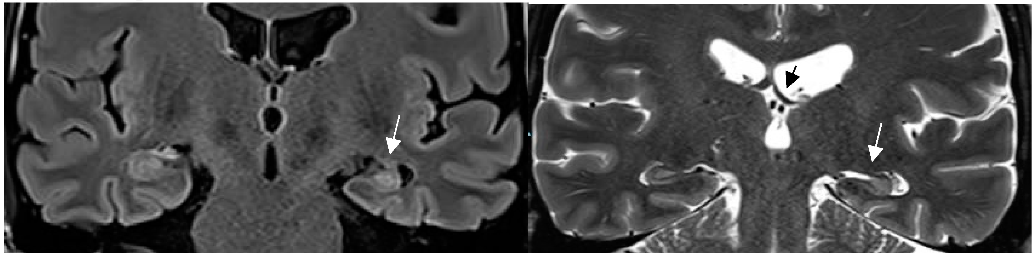 Preprints 151405 g002