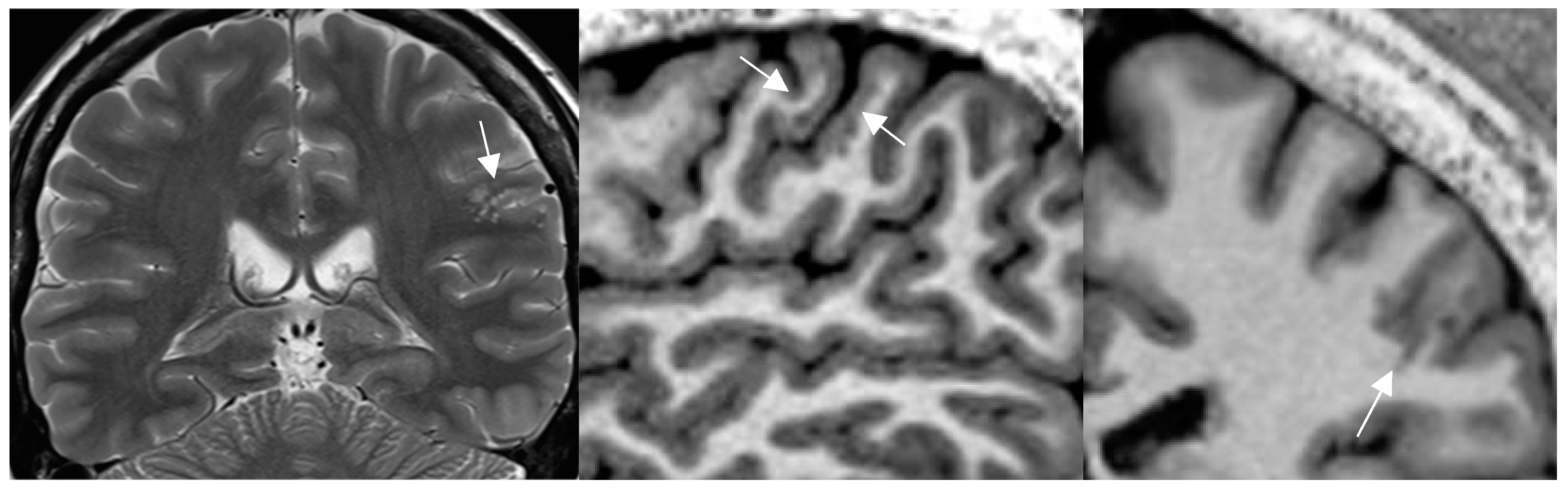 Preprints 151405 g003