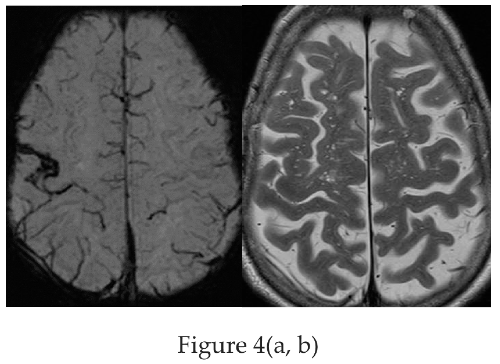 Preprints 151405 g004