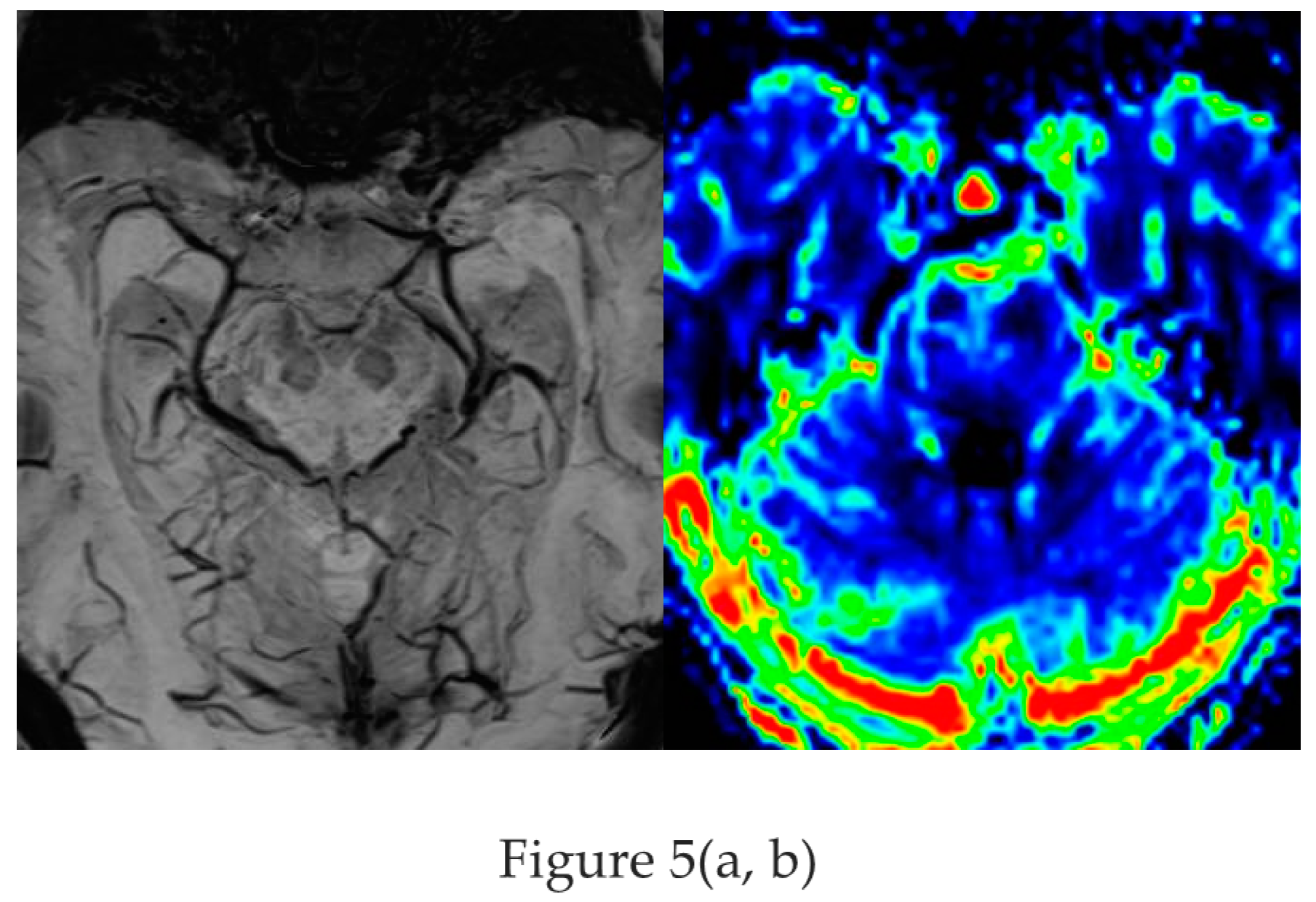 Preprints 151405 g005