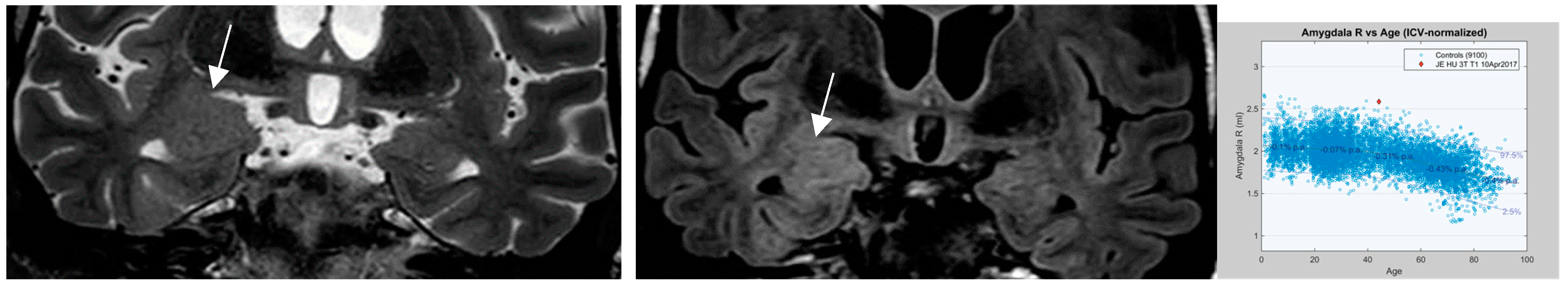 Preprints 151405 g011