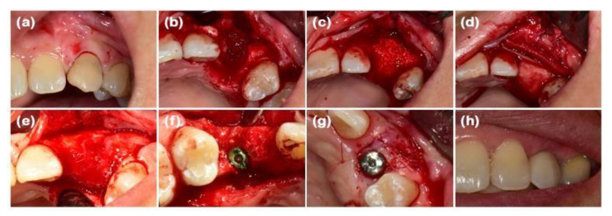 Preprints 138956 g001