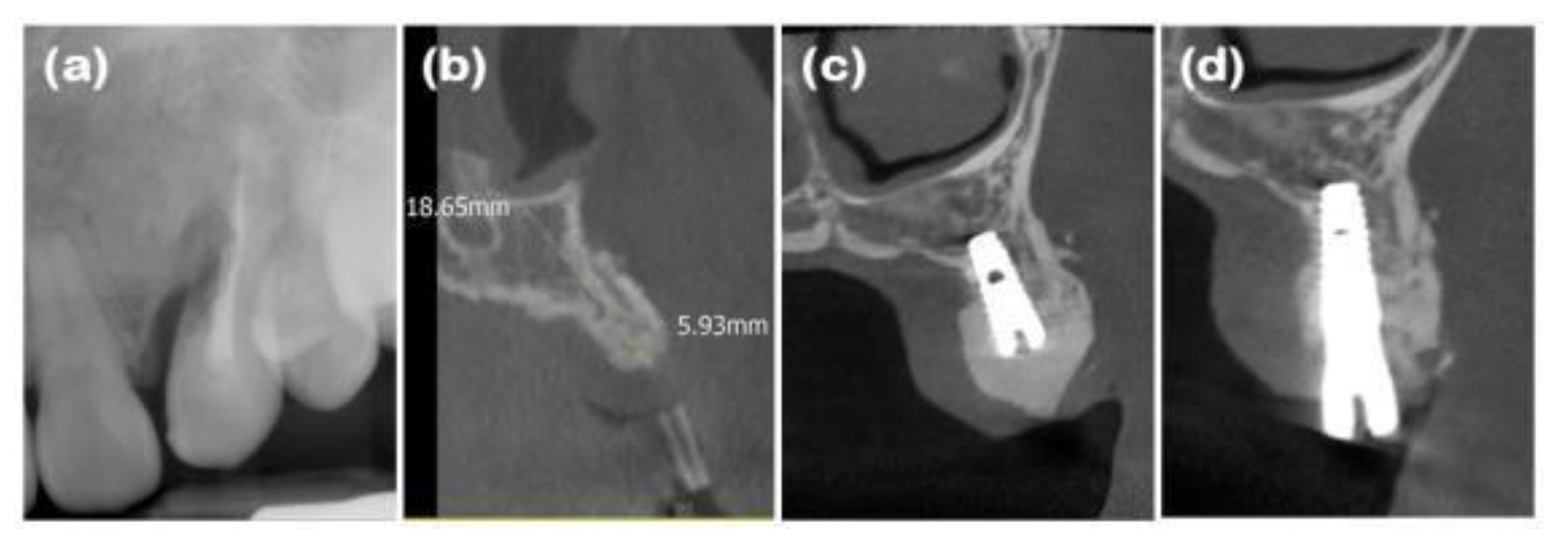 Preprints 138956 g002