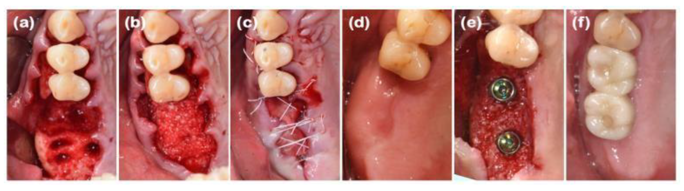 Preprints 138956 g003