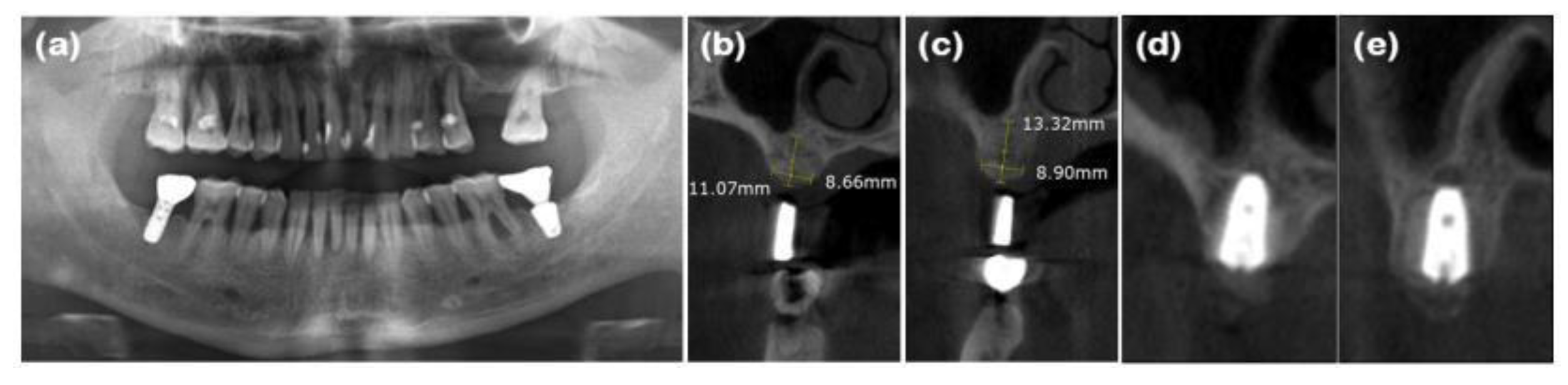 Preprints 138956 g004
