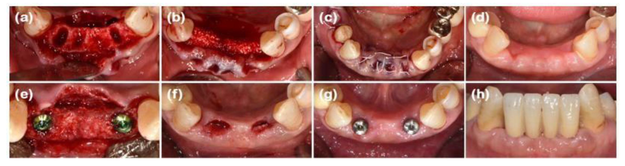 Preprints 138956 g005