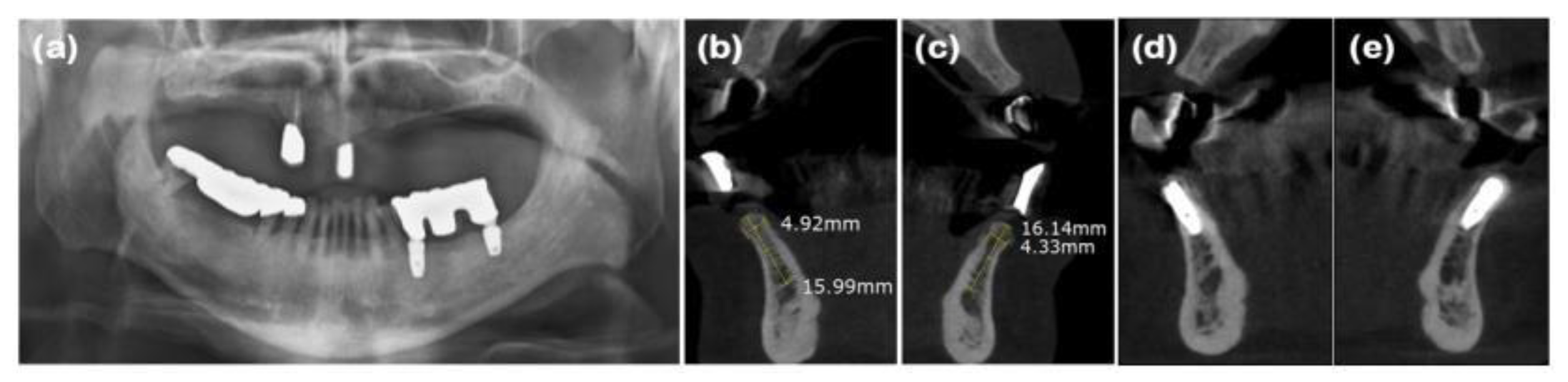 Preprints 138956 g006