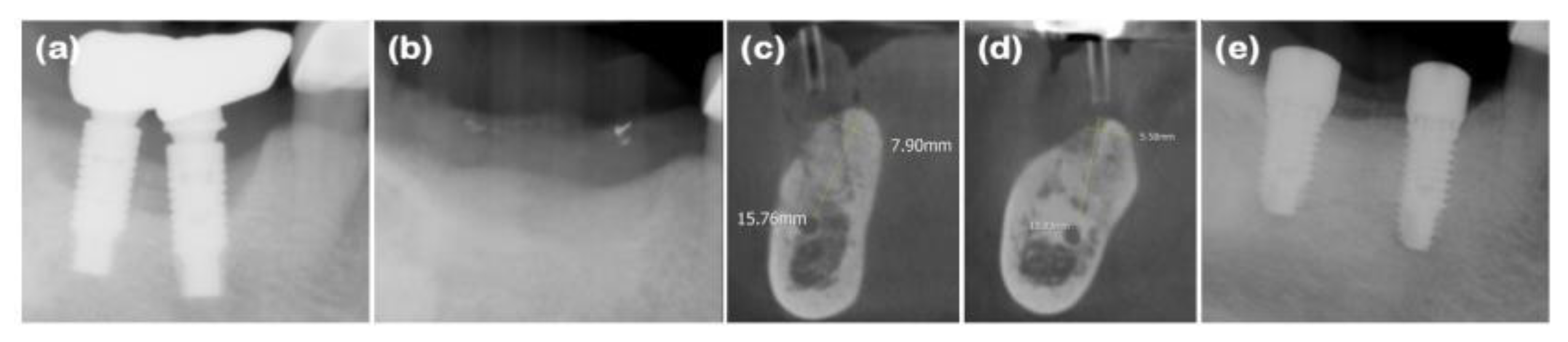 Preprints 138956 g008